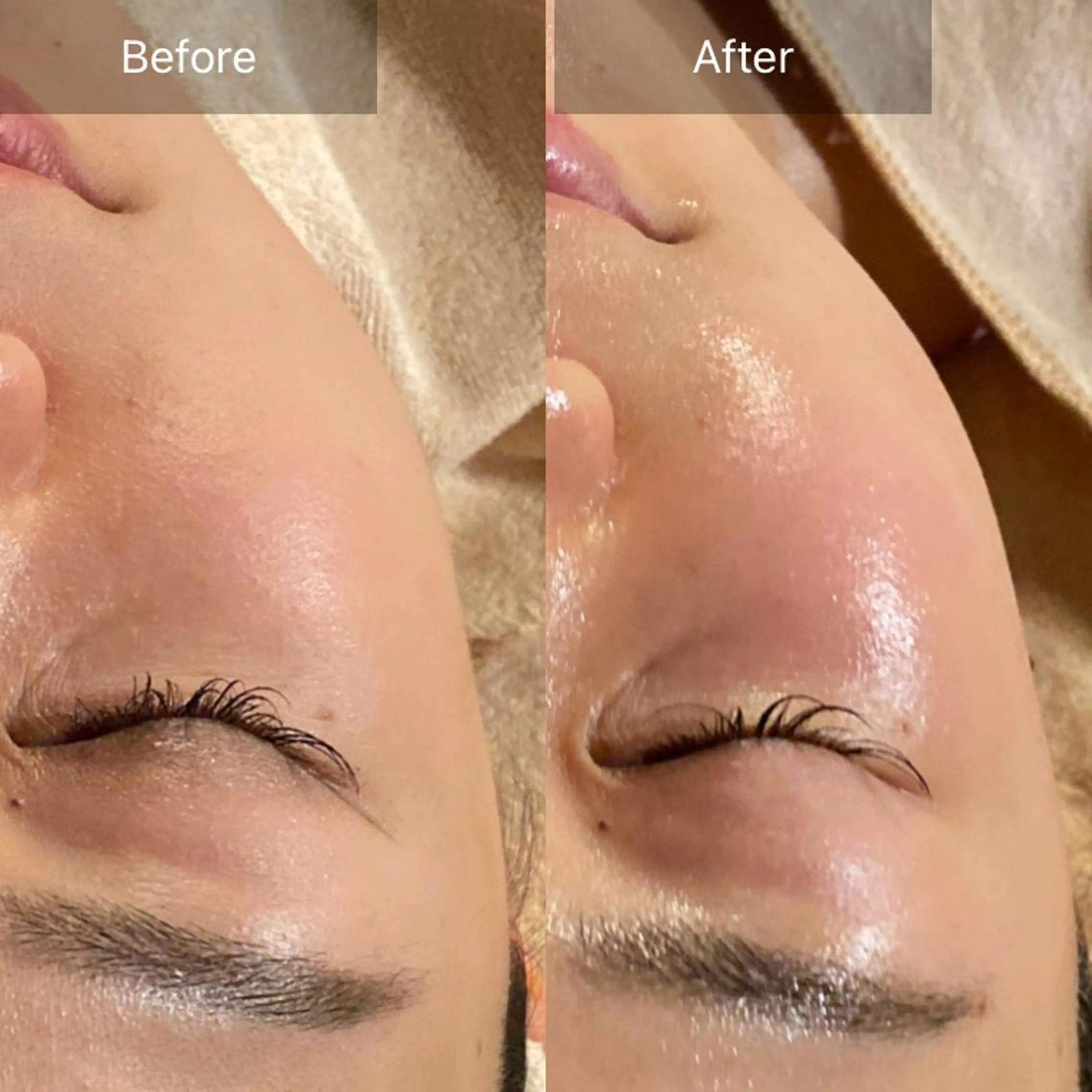 毛穴から始める肌メン テマンダリンオレンジのエステ・リラクイメージ