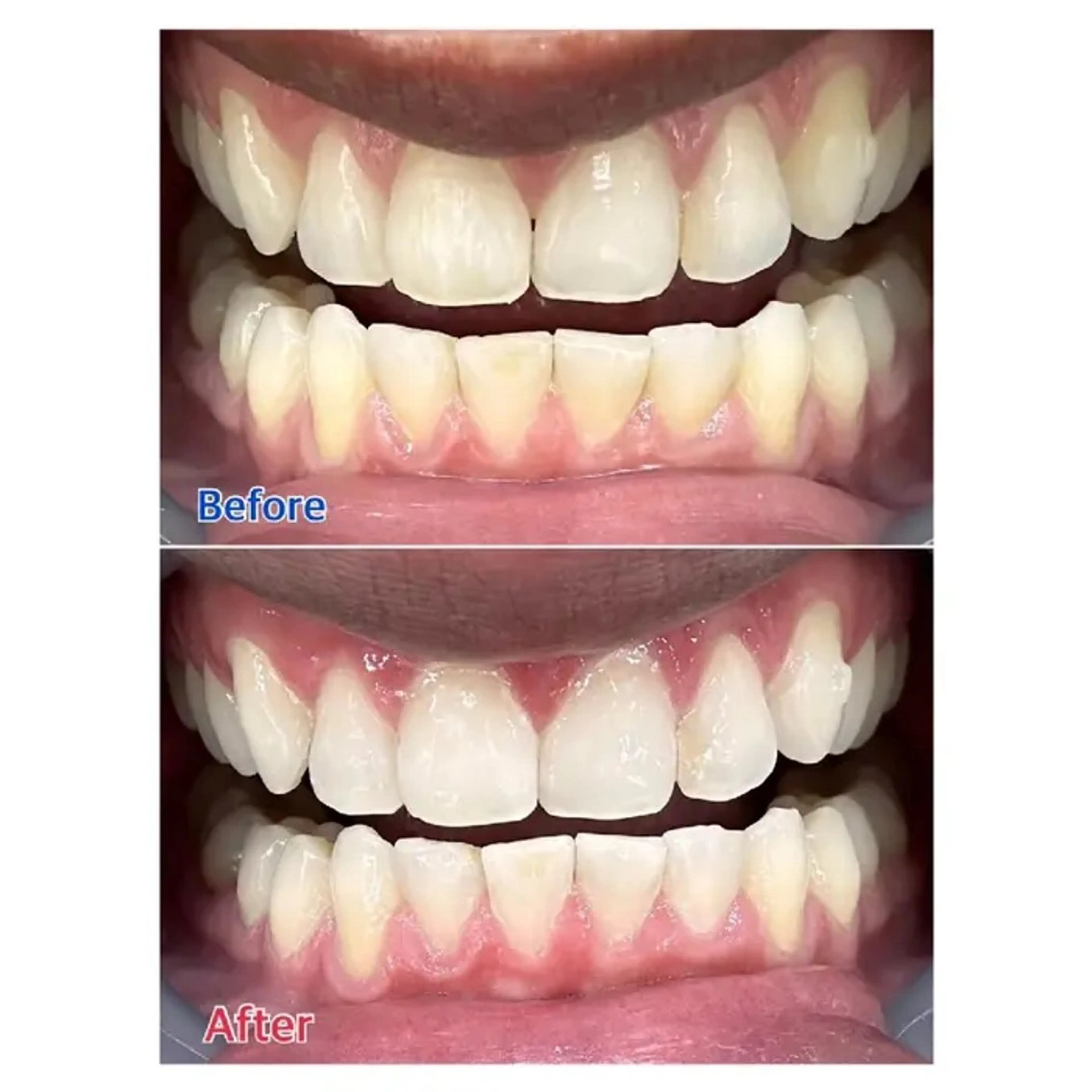 M渋谷 ホワイトニングのエステ・リラクイメージ