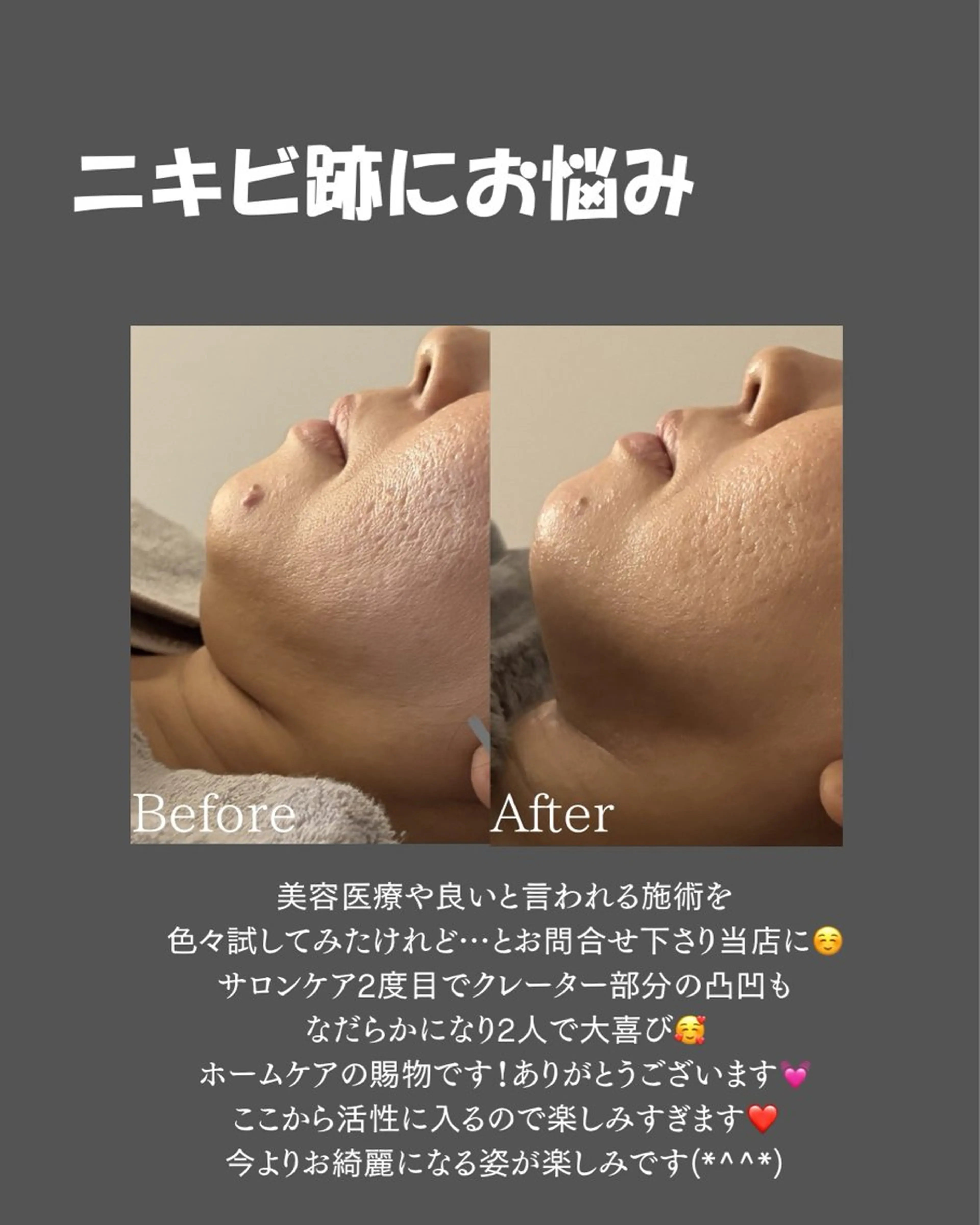 BLOSSOM 菊地のエステ・リラクイメージ