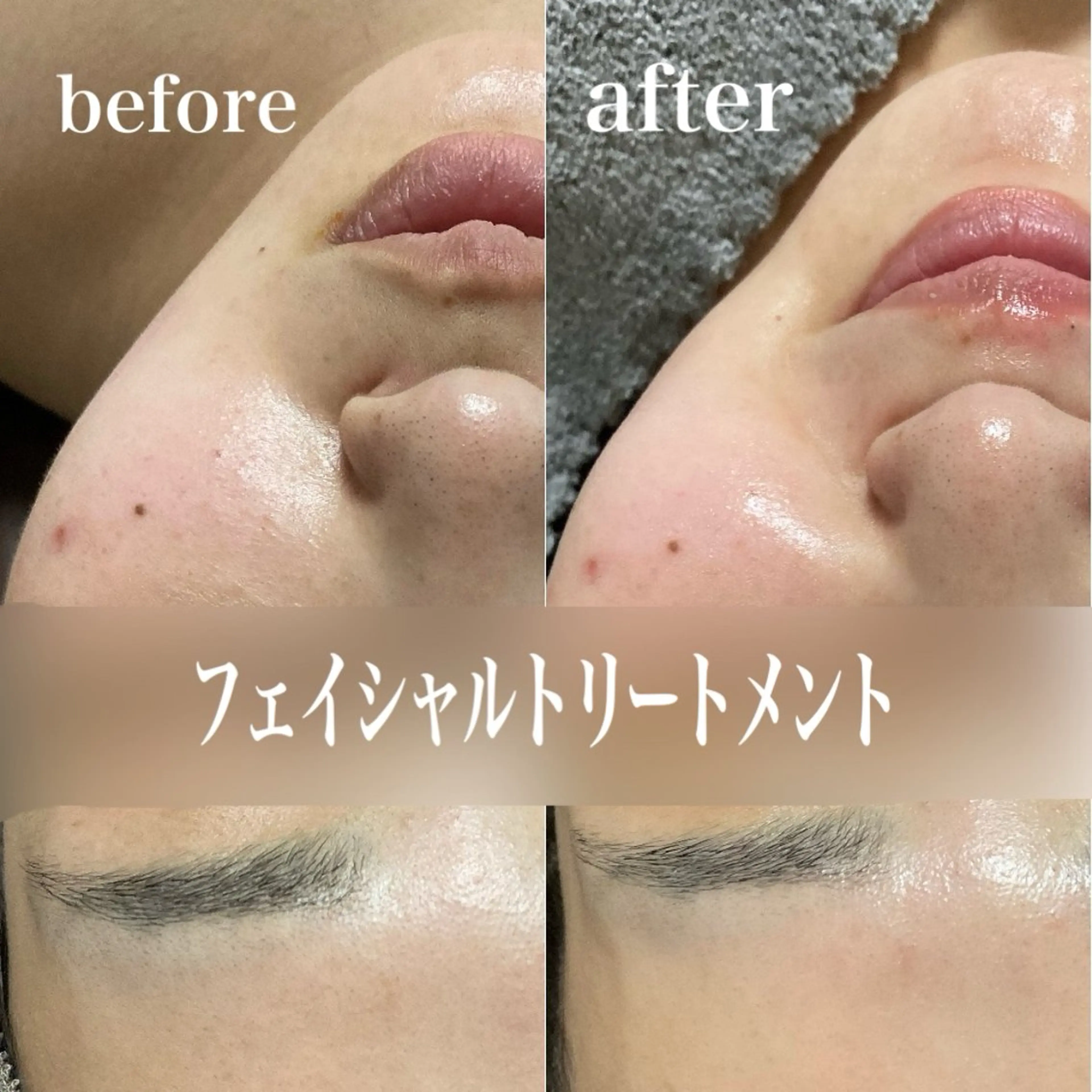 磐田｜LAYLA 一番丁寧な脱毛店のエステ・リラクイメージ