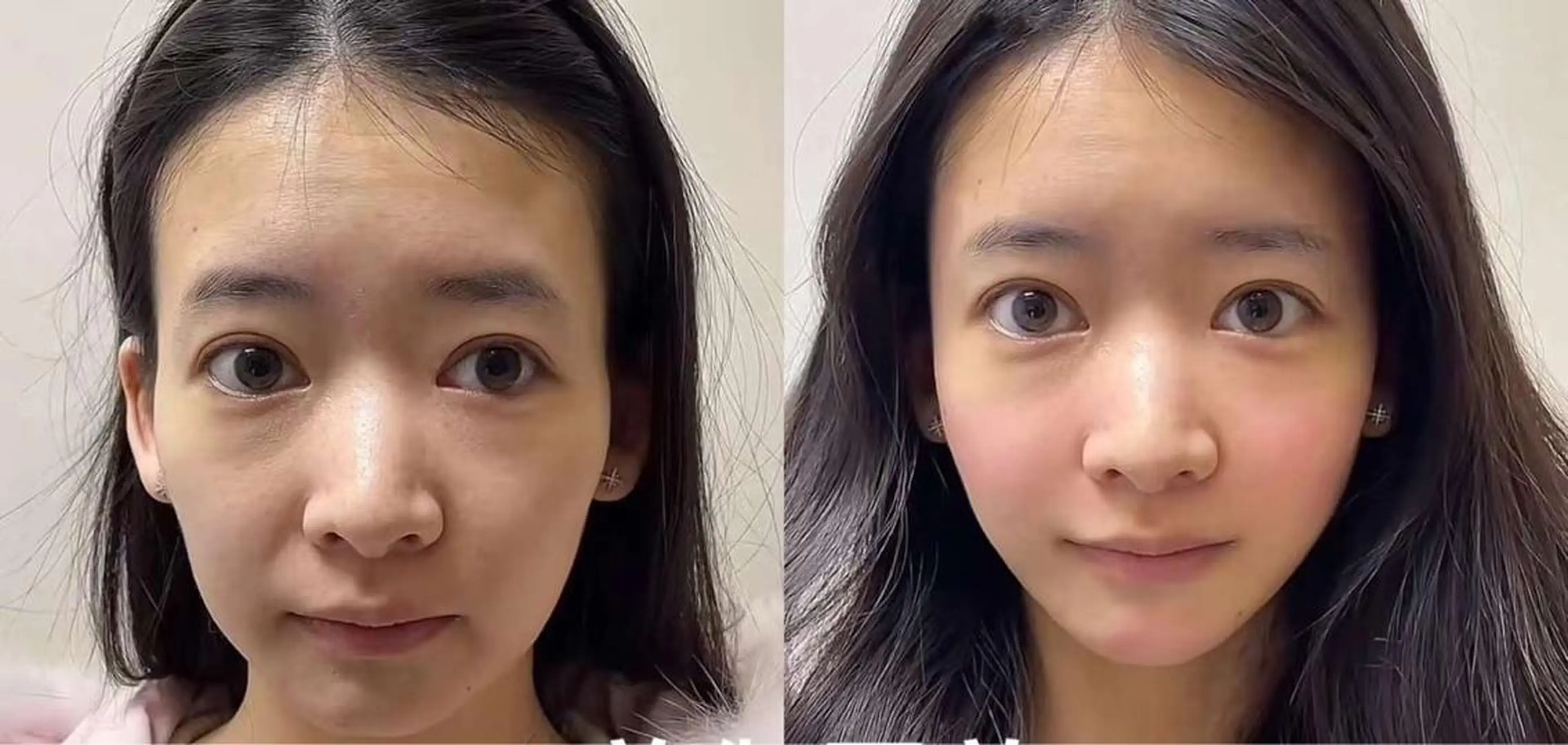 エステ aliaハーブ水光店 エステティシャン募集のエステ・リラクイメージ