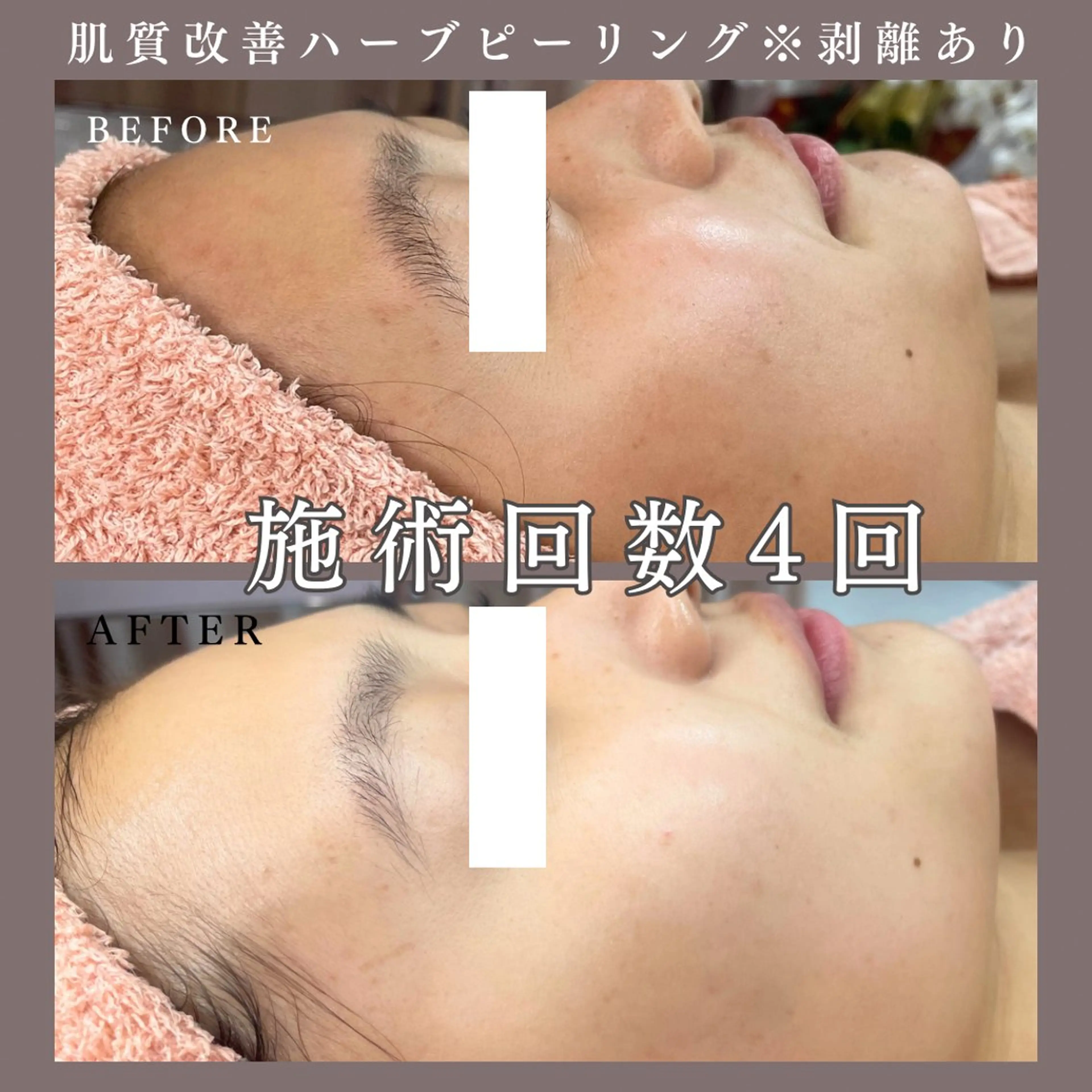 肌質改善専門サロン Bellmi/心斎橋のエステ・リラクイメージ