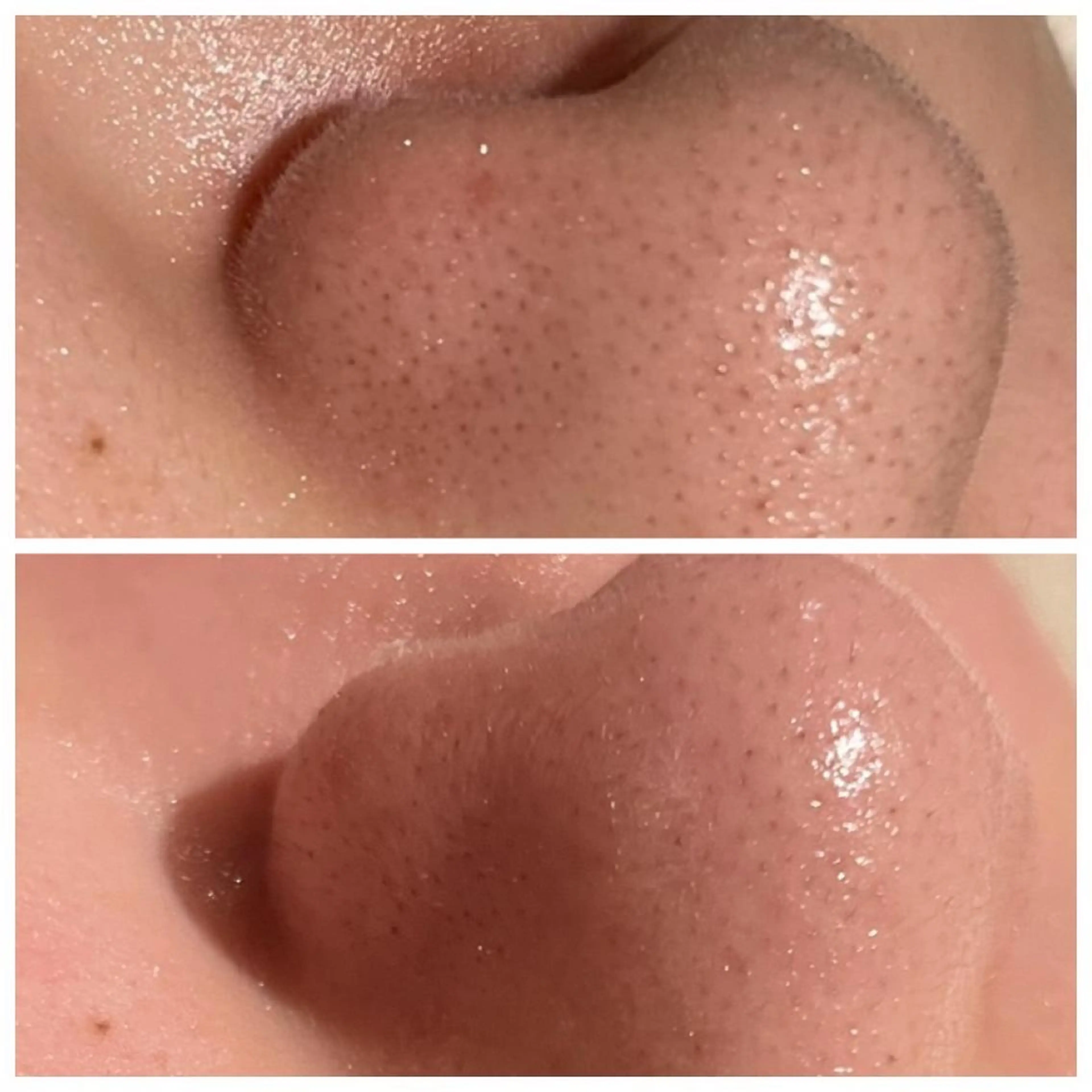 エステ 森 美優のエステ・リラクイメージ