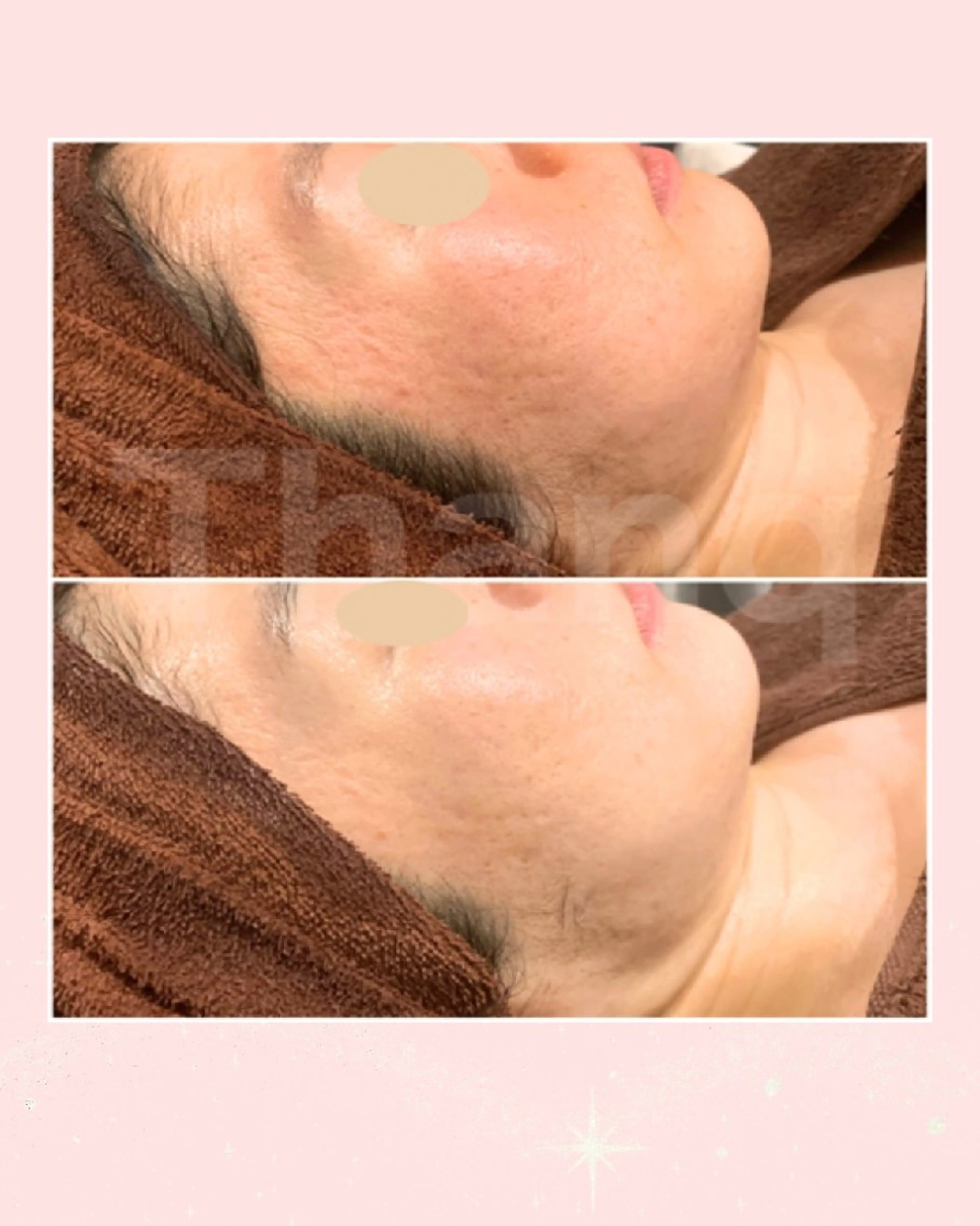 エステ サンク 飯田（イイダ）のエステ・リラクイメージ