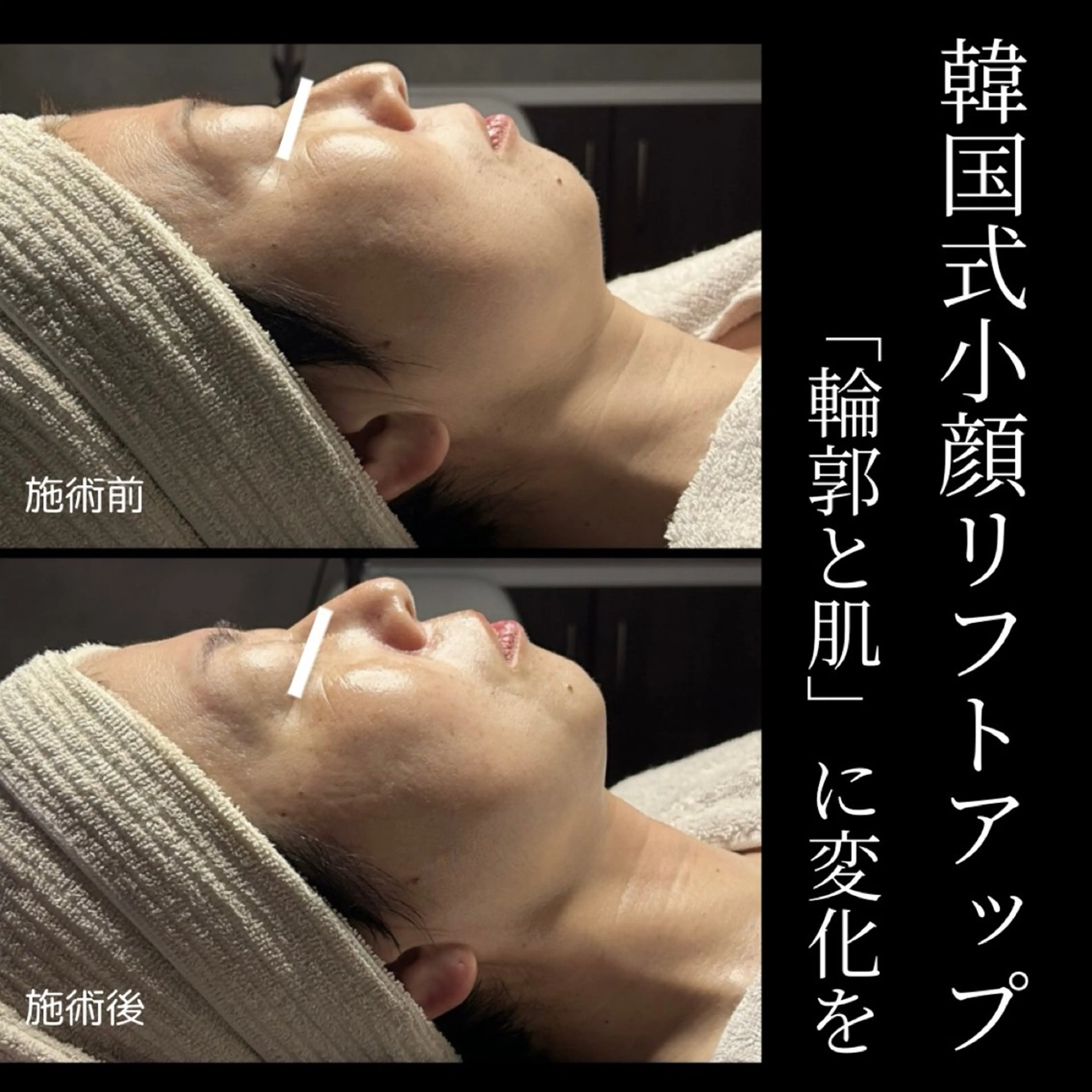 美顔・小顔専門店 LOUISの眉毛・アイブロウイメージ