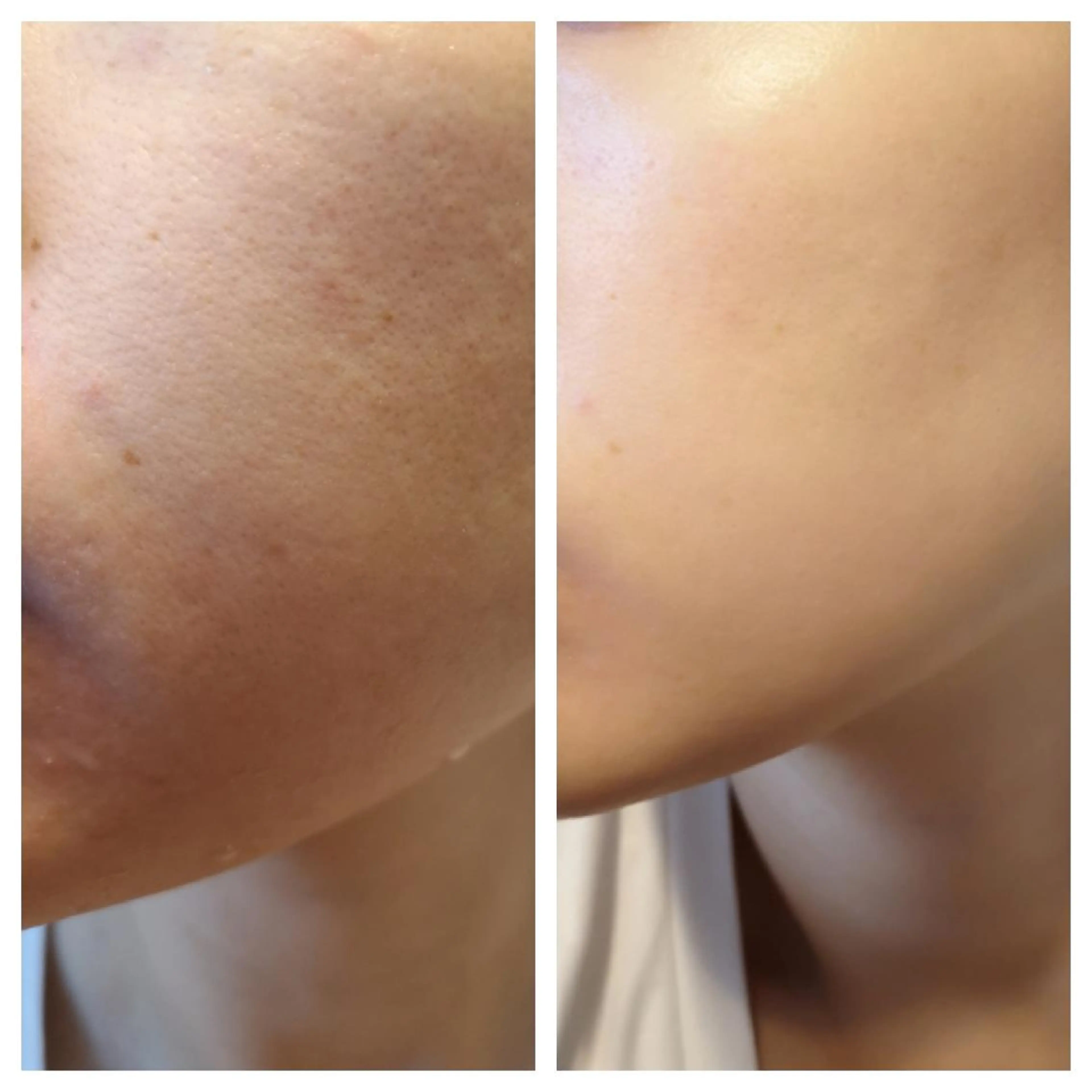 🅖🅤🅩🅔🅛 salonのエステ・リラクイメージ