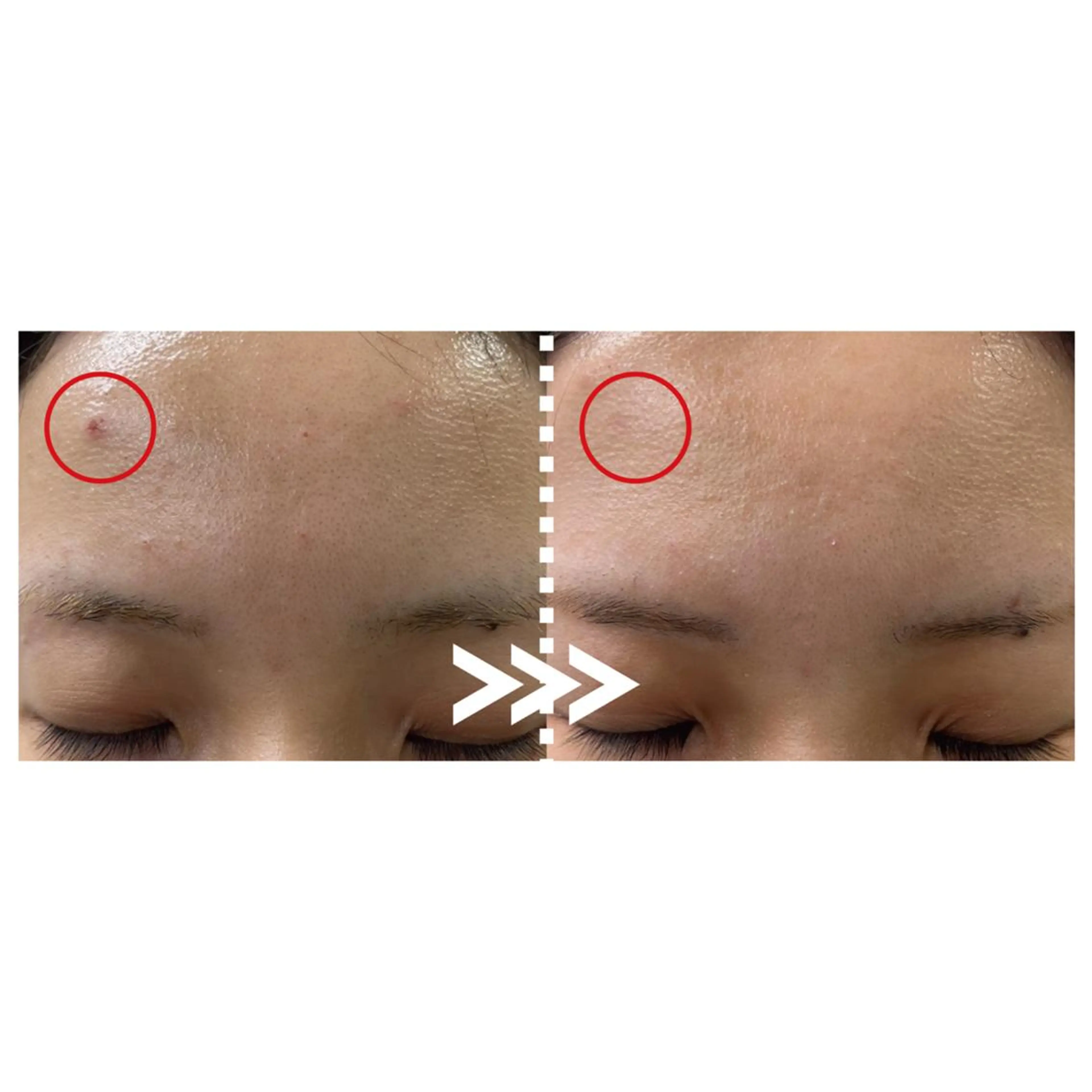 エステ 肌質改善専門 ハーブ /毛穴洗浄 リエイトのエステ・リラクイメージ