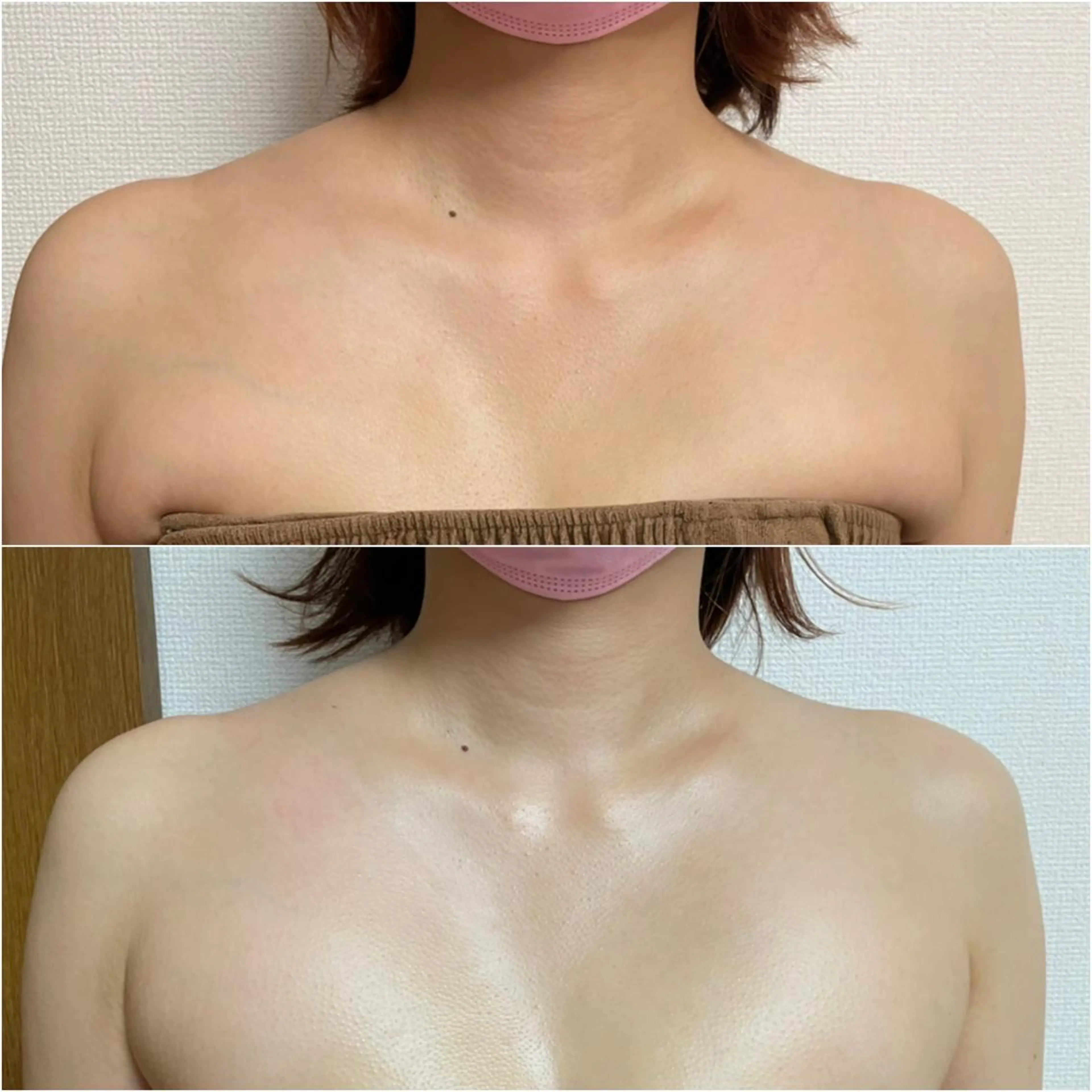 Linomalie エステ/たるみ/脱毛のエステ・リラクイメージ