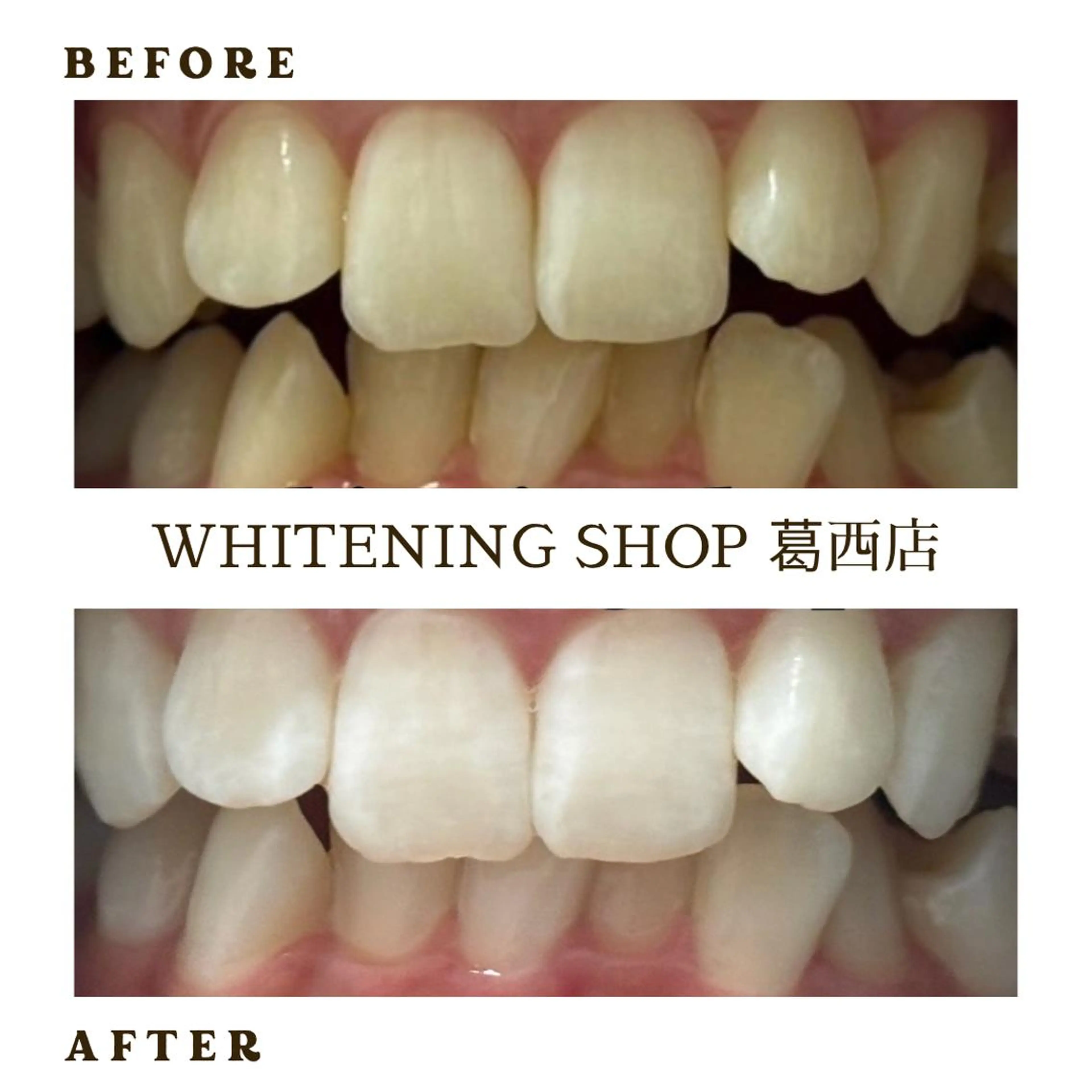 メンズ その他 ホワイトニング ショップ葛西店のその他イメージ