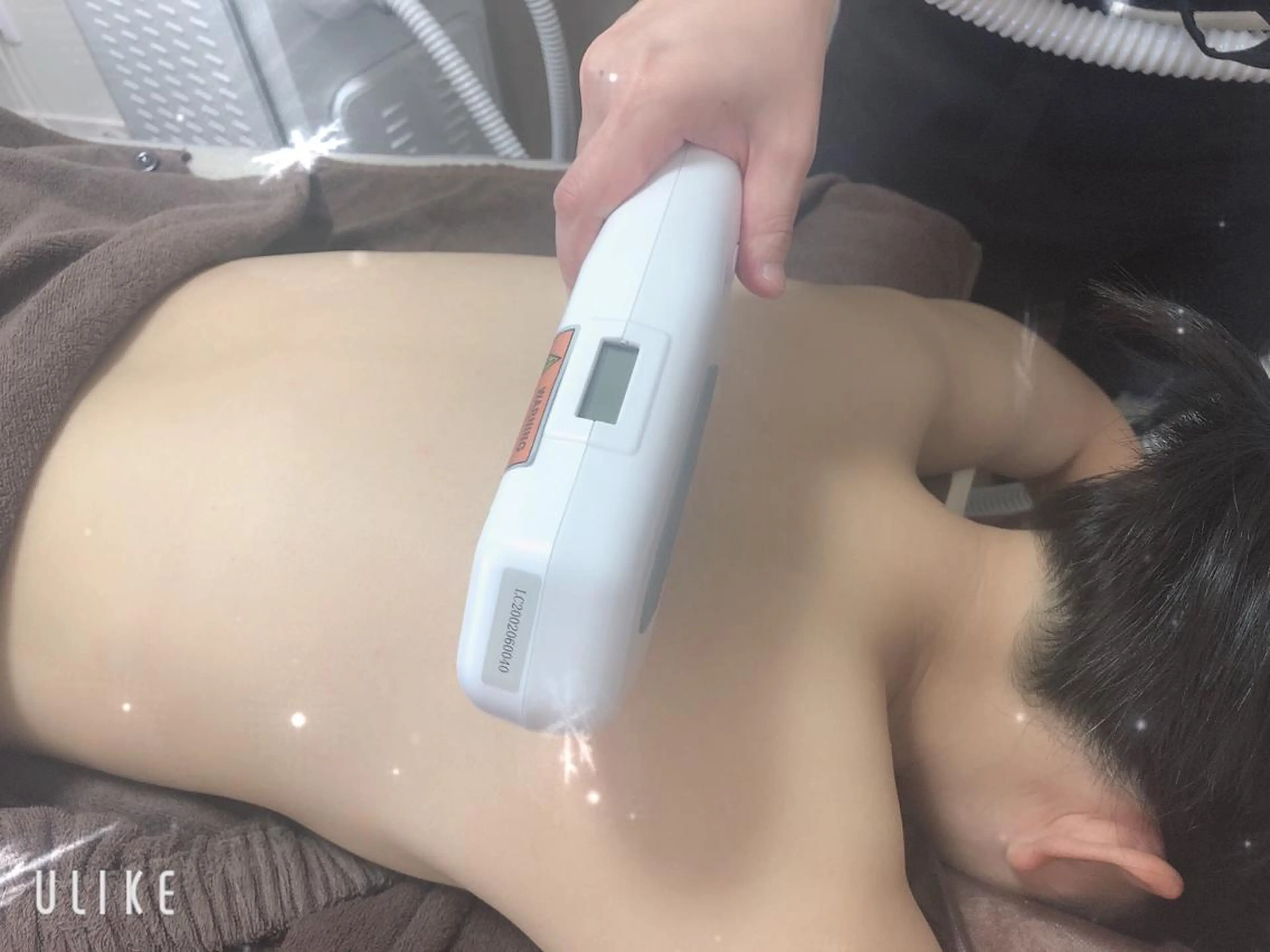 うなじ＆背中脱毛の写真