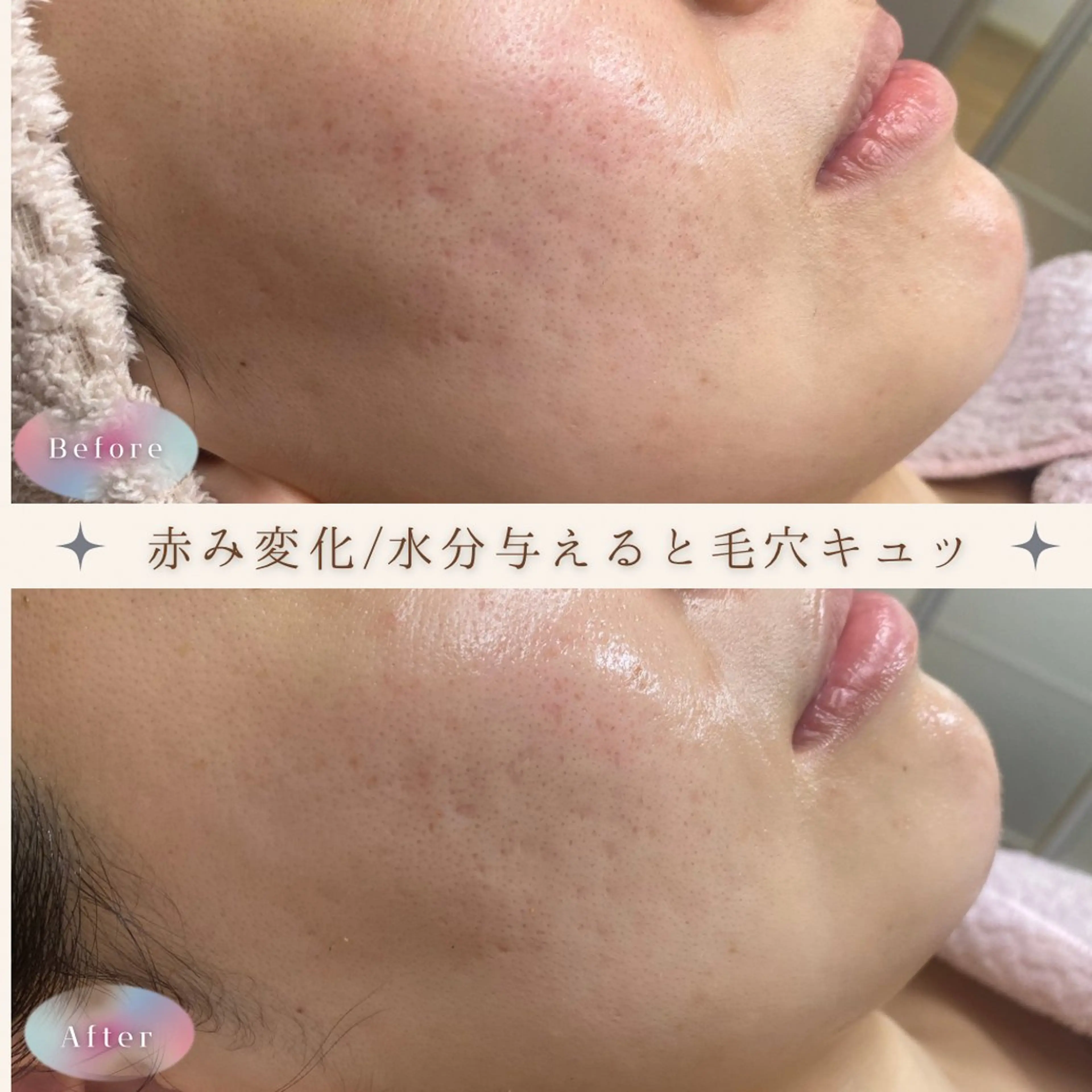 肌質改善サロン with Uのエステ・リラクイメージ