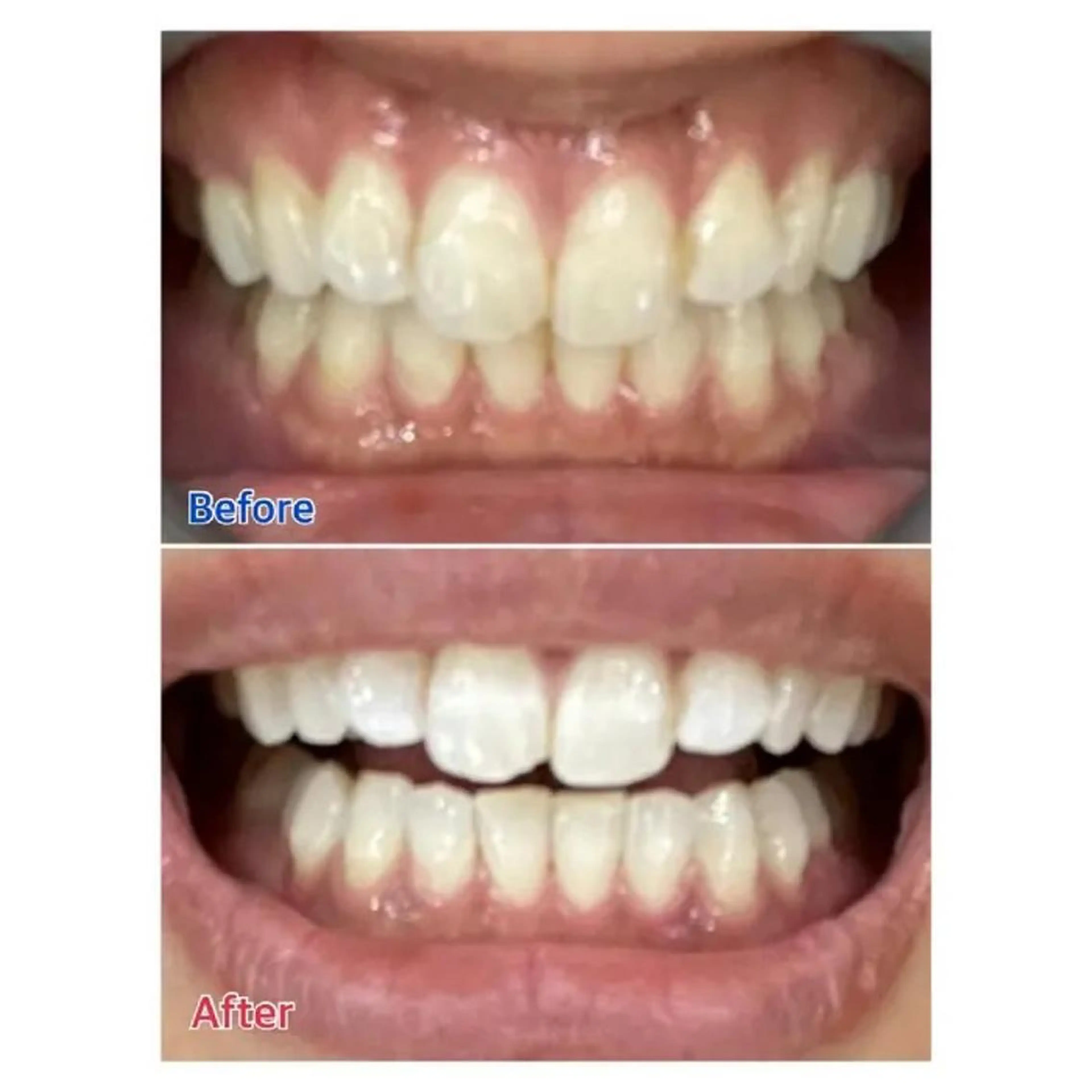 M渋谷 ホワイトニングのエステ・リラクイメージ