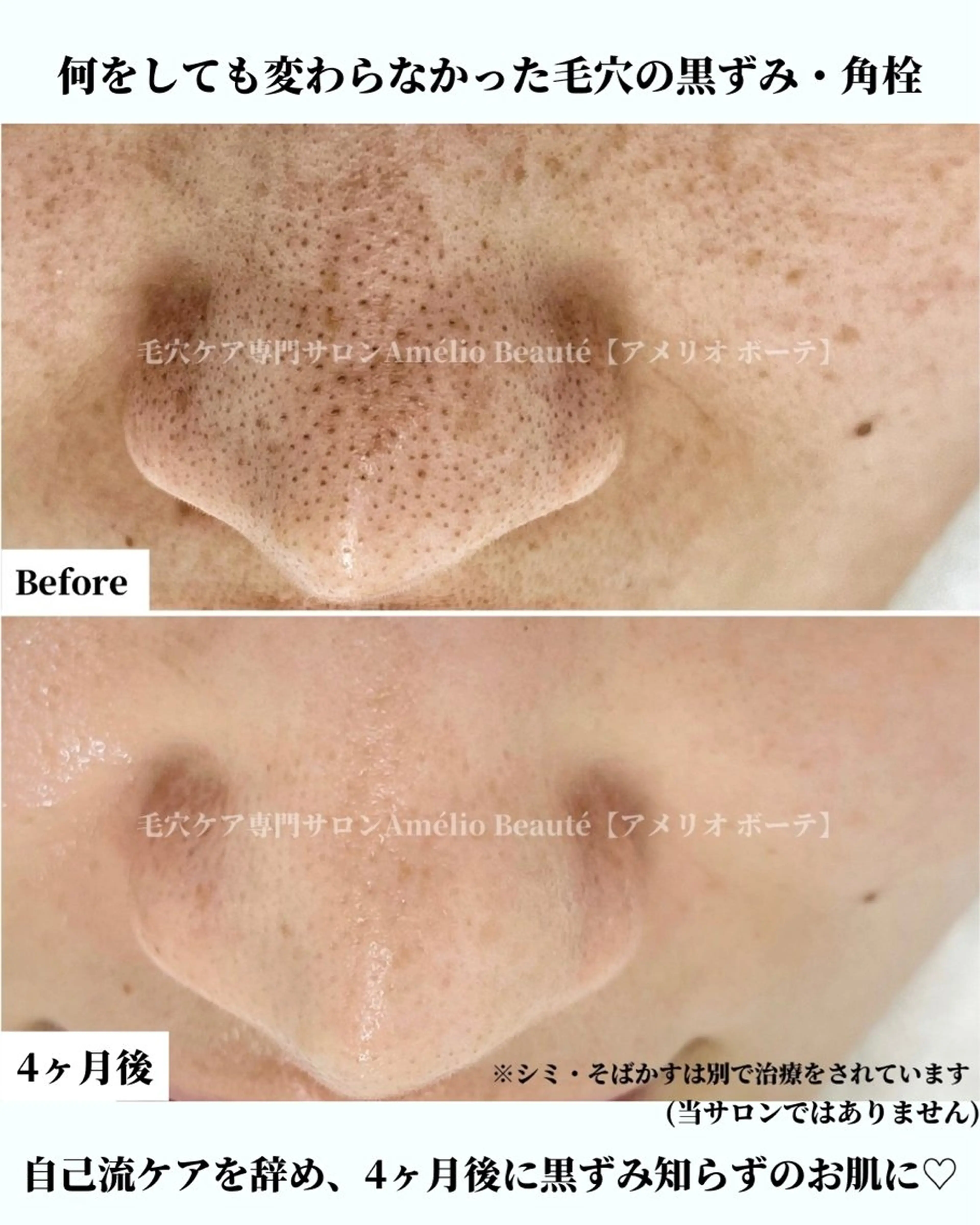 メンズ 毛穴ケア専門サロン アメリオボーテのその他イメージ