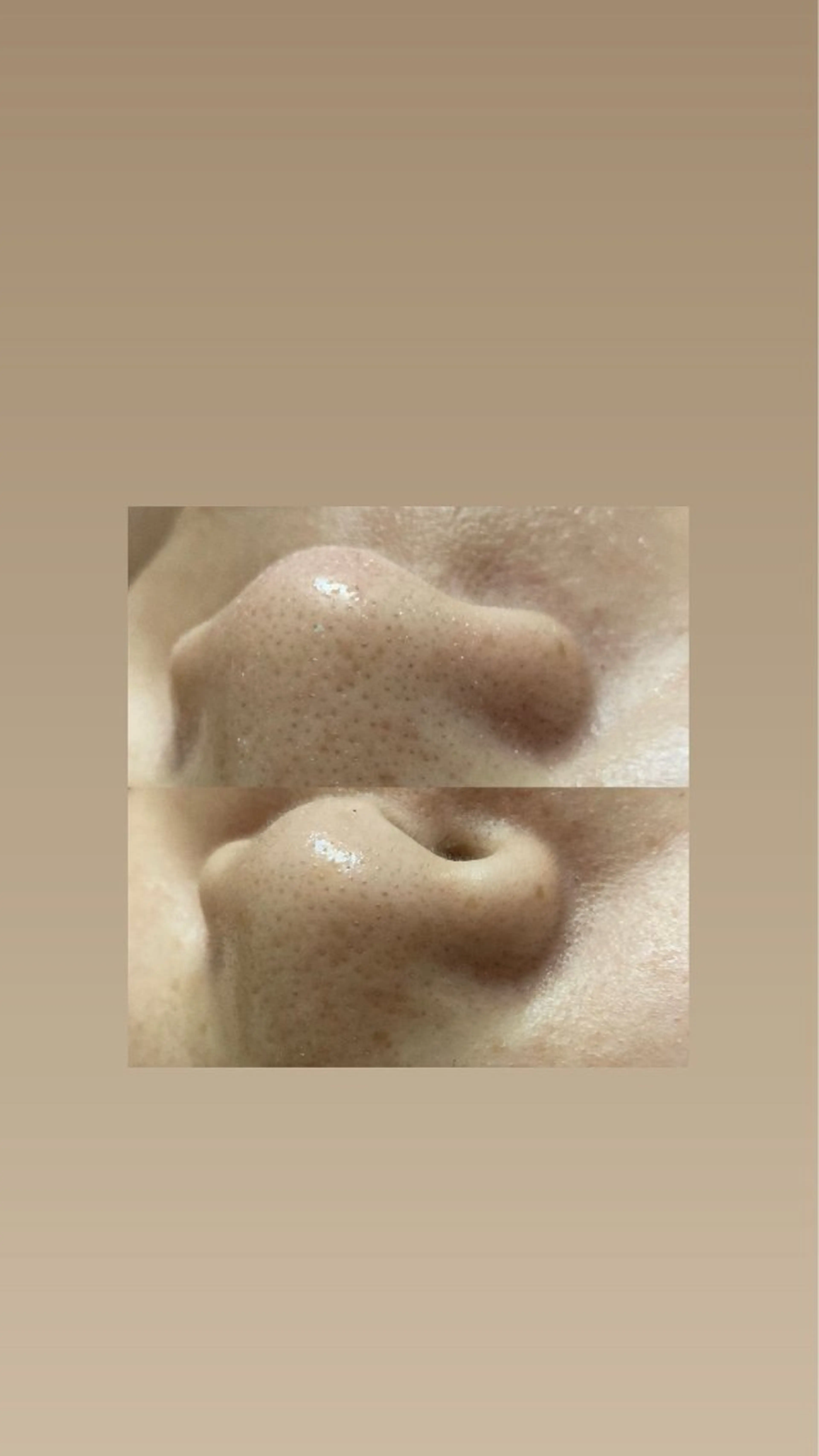 磐田｜LAYLA 一番丁寧な脱毛店のエステ・リラクイメージ