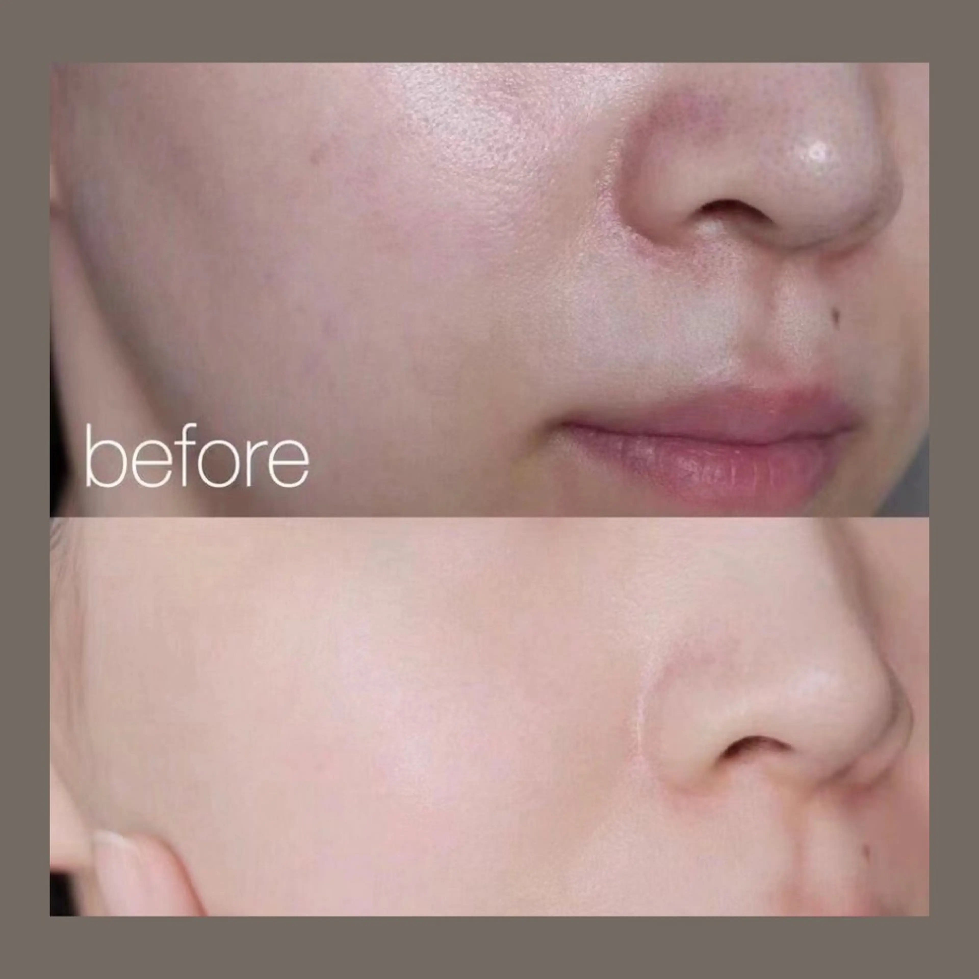 エステ リラク 愛維美水光美肌専門店所属・愛維美水光美肌専門店 メンズレディースokのエステ・リラクイメージ