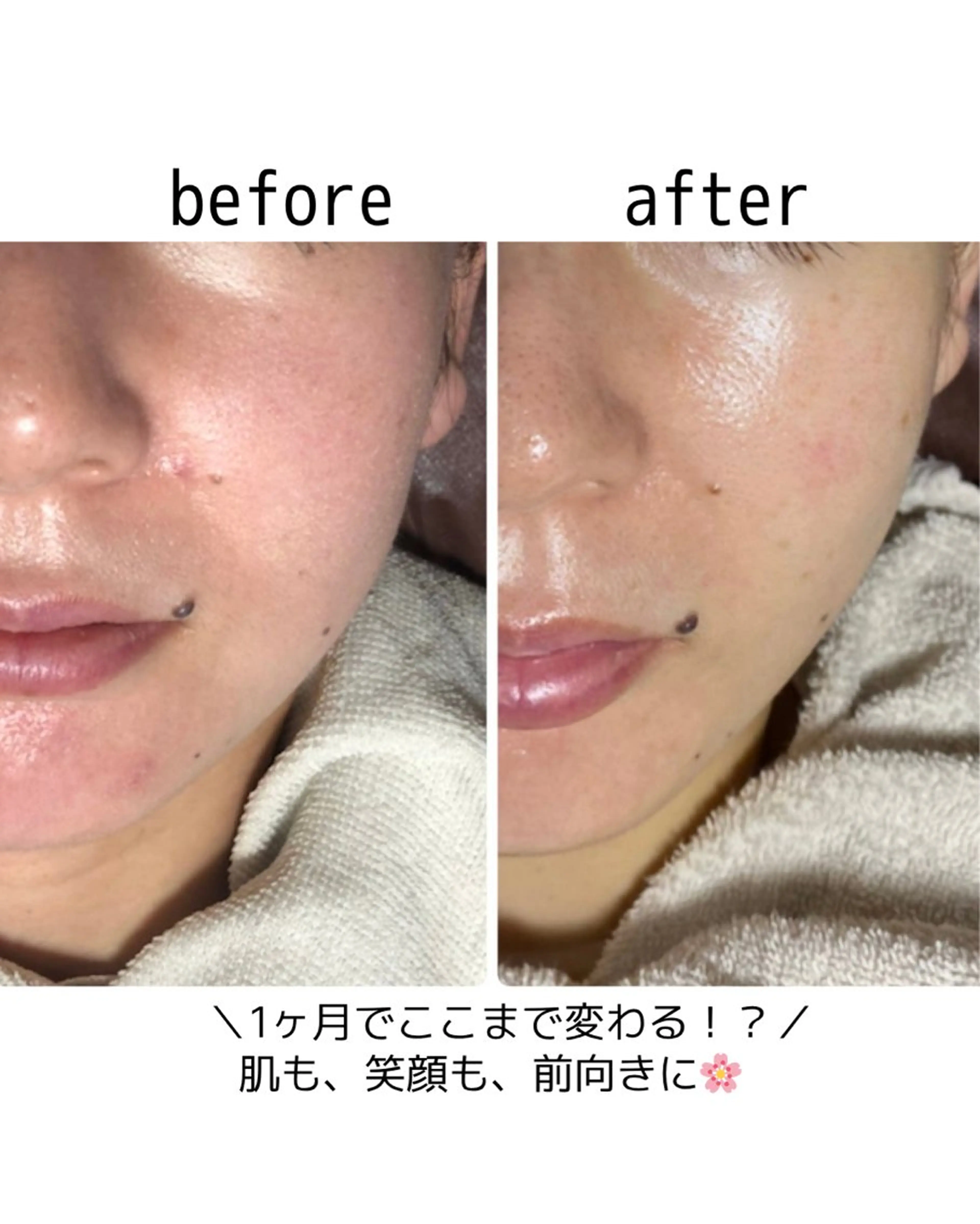 エステ 小顔・毛穴・たるみ ネイル　似内真樹のエステ・リラクイメージ