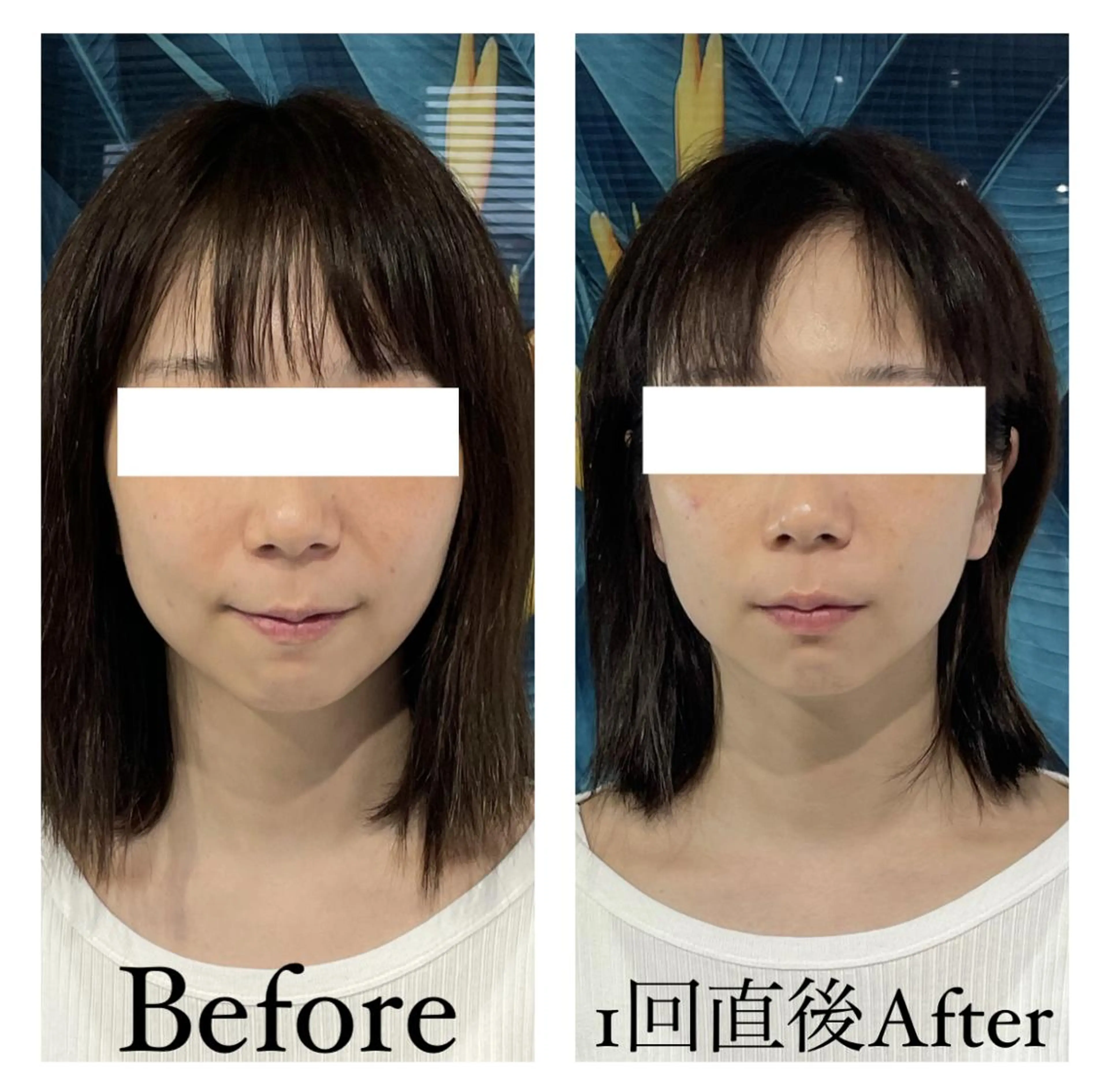 エステ リラク 部分痩せ♥️小顔専門 MIKUのエステ・リラクイメージ