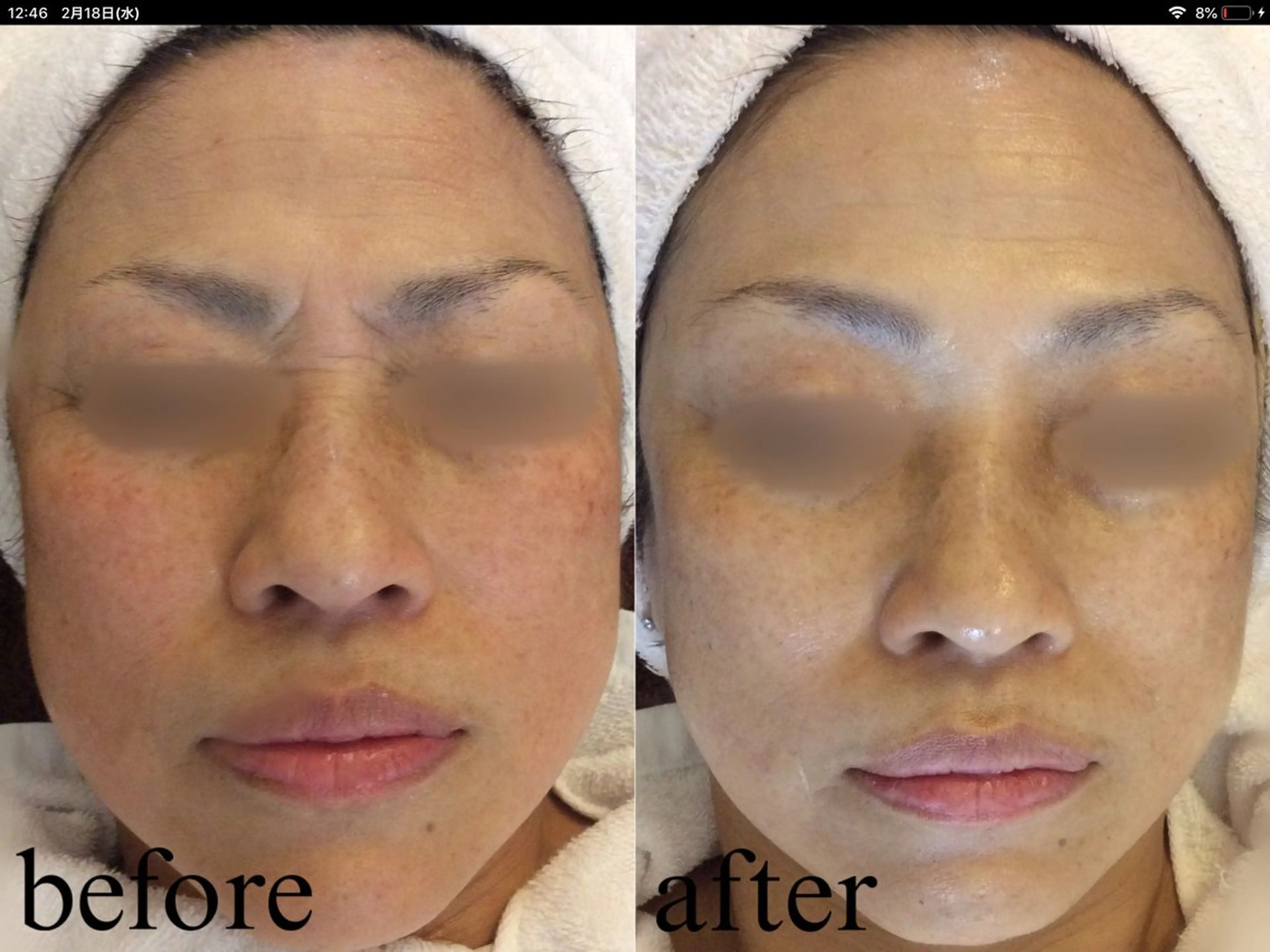 エステ サロン ド ビス 髙橋美月のエステ・リラクイメージ