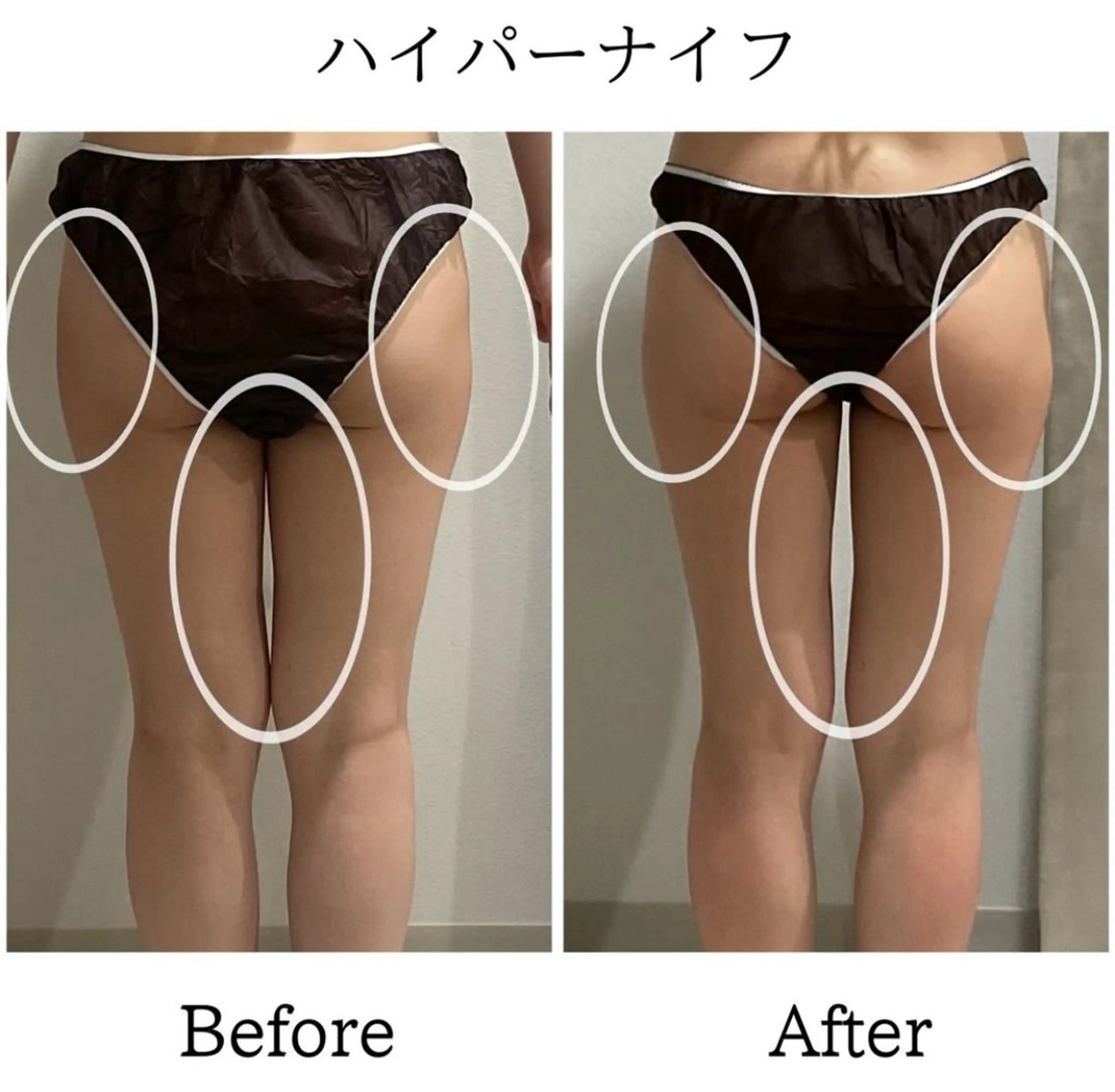 下半身痩せ🔥パンツ・スカートが映える脚に👗短時間でスッキリ!¥25,300→¥6,600の写真