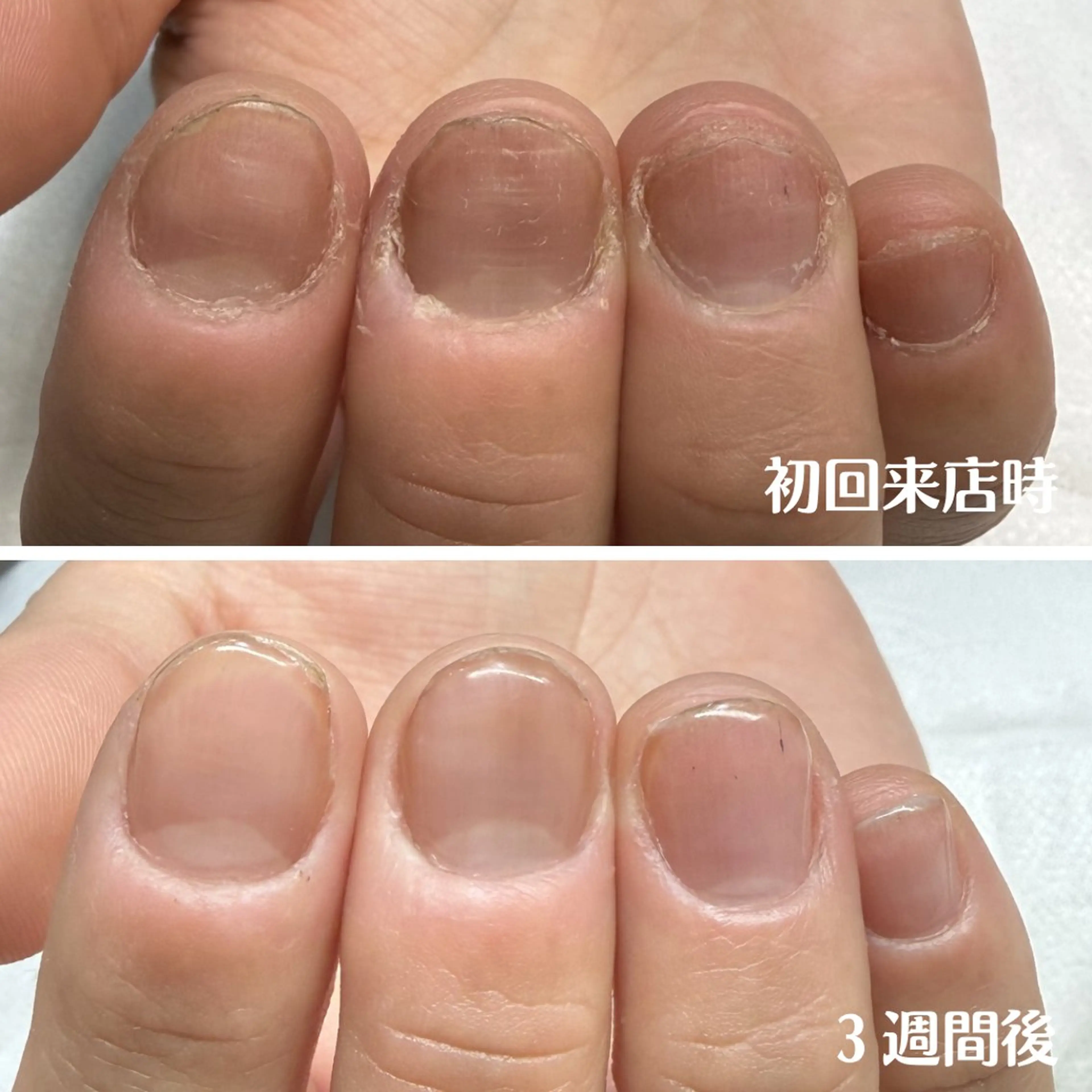 ネイル ハンドネイル ハンドケア 郷湖 かおりのネイルデザイン