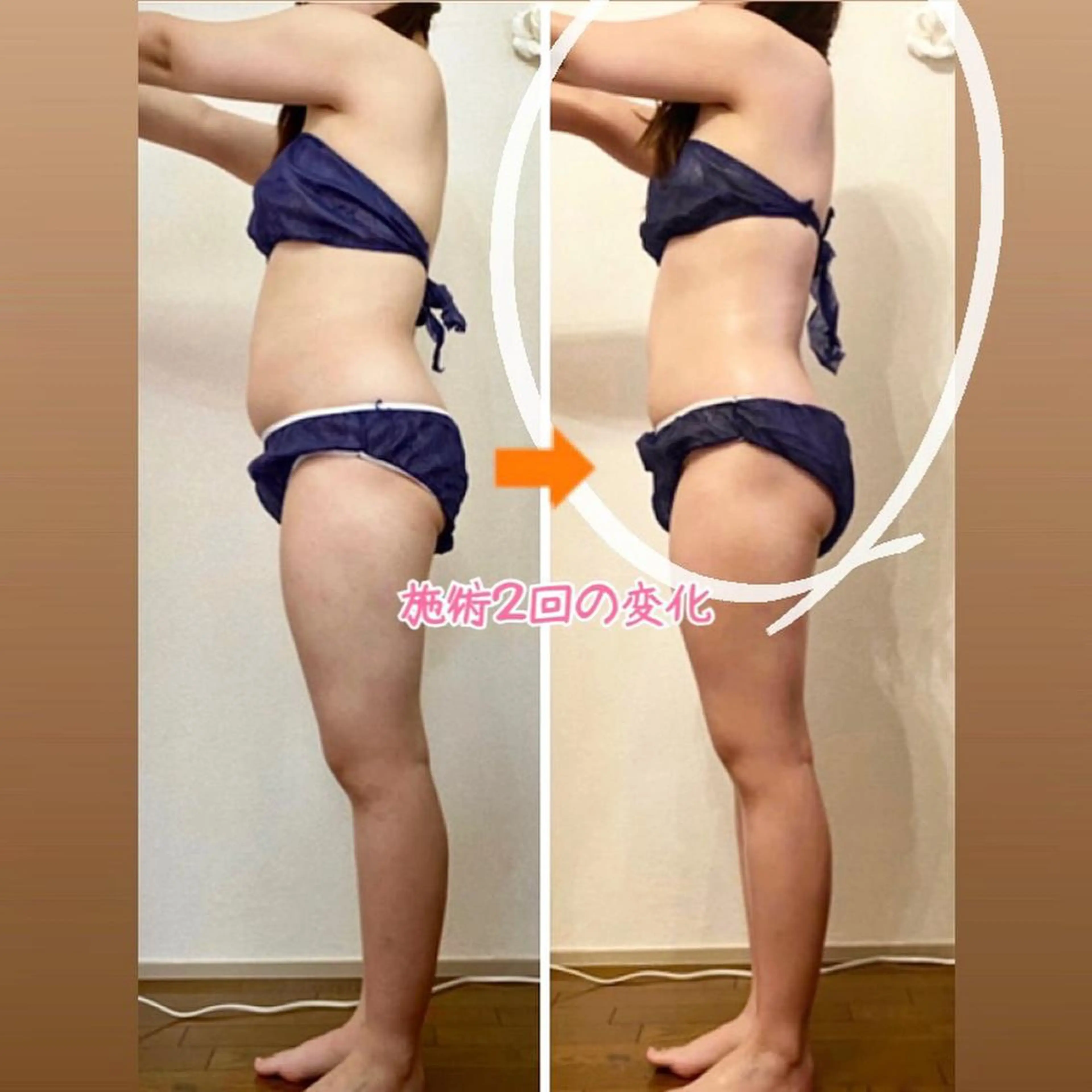 ショート カラー パーマ ヘアアレンジ メンズ キッズ ネイル マツエク・マツパ ‍痩身＆ボディ 結果出し🌟丹野のエステ・リラクイメージ