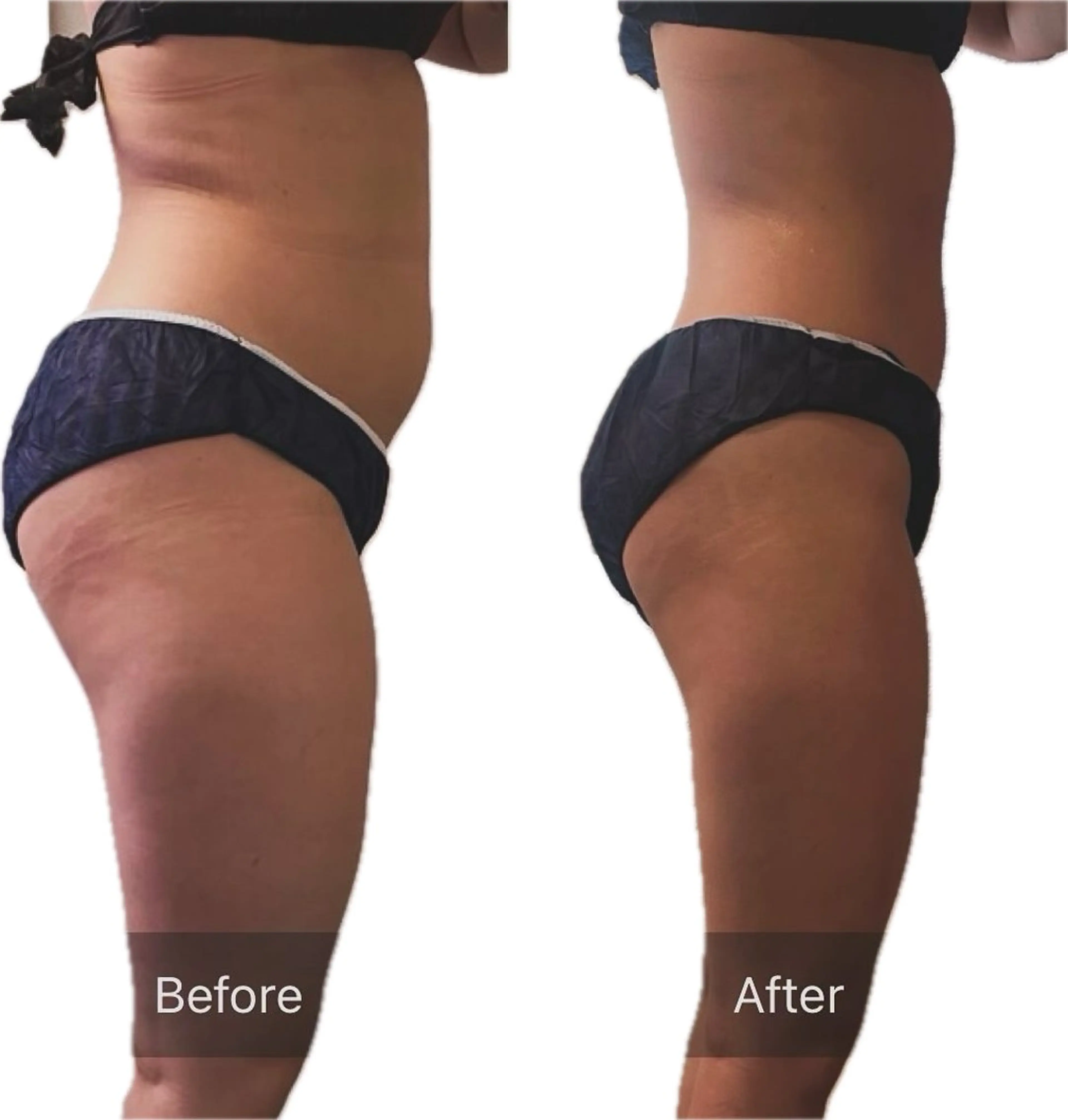 A.所属・Raviy(A.) 【痩身・韓国肌管理】のエステ・リラクイメージ