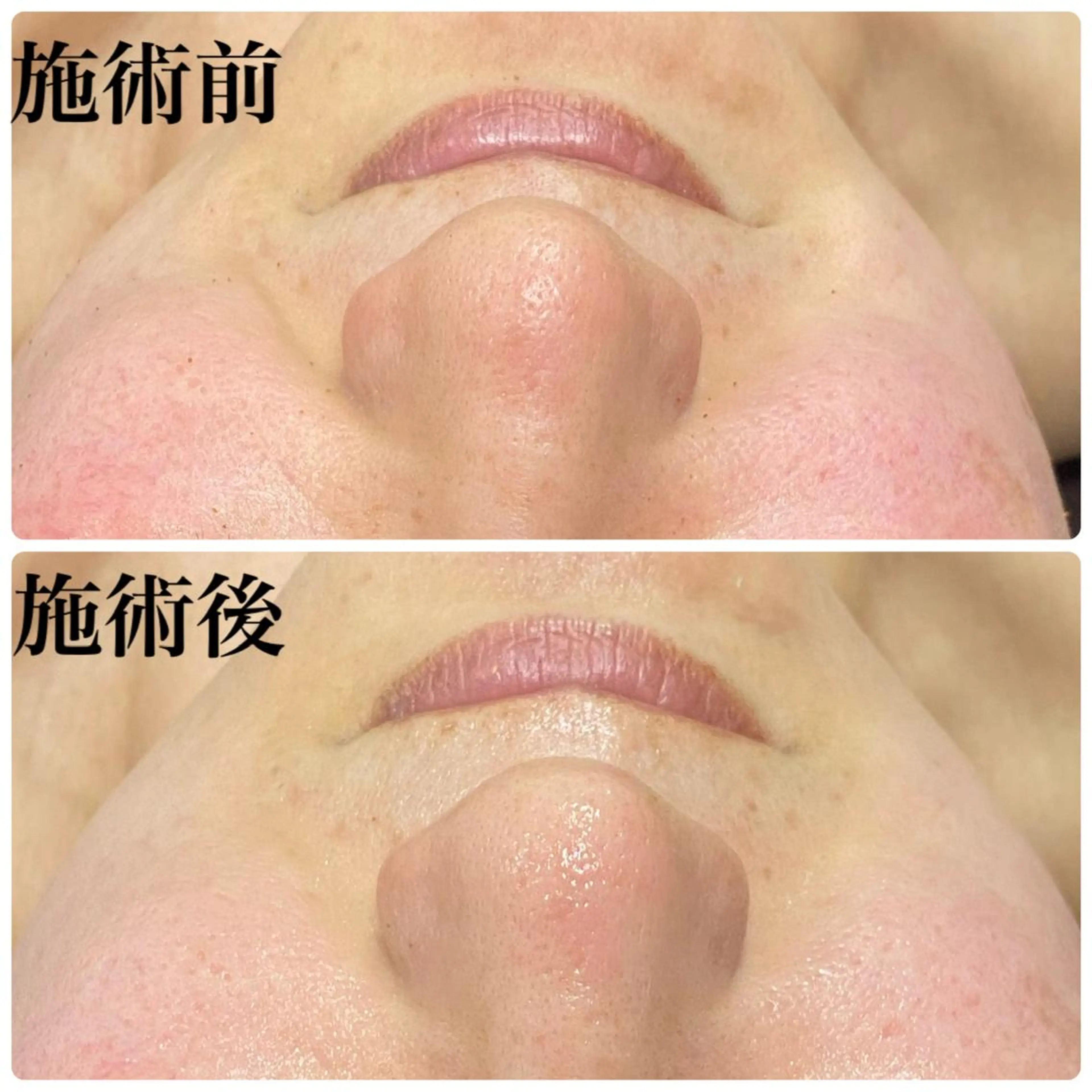 ハーブピーリング専門店 Ribboｰn所属・川田 弥生のエステ・リラクイメージ