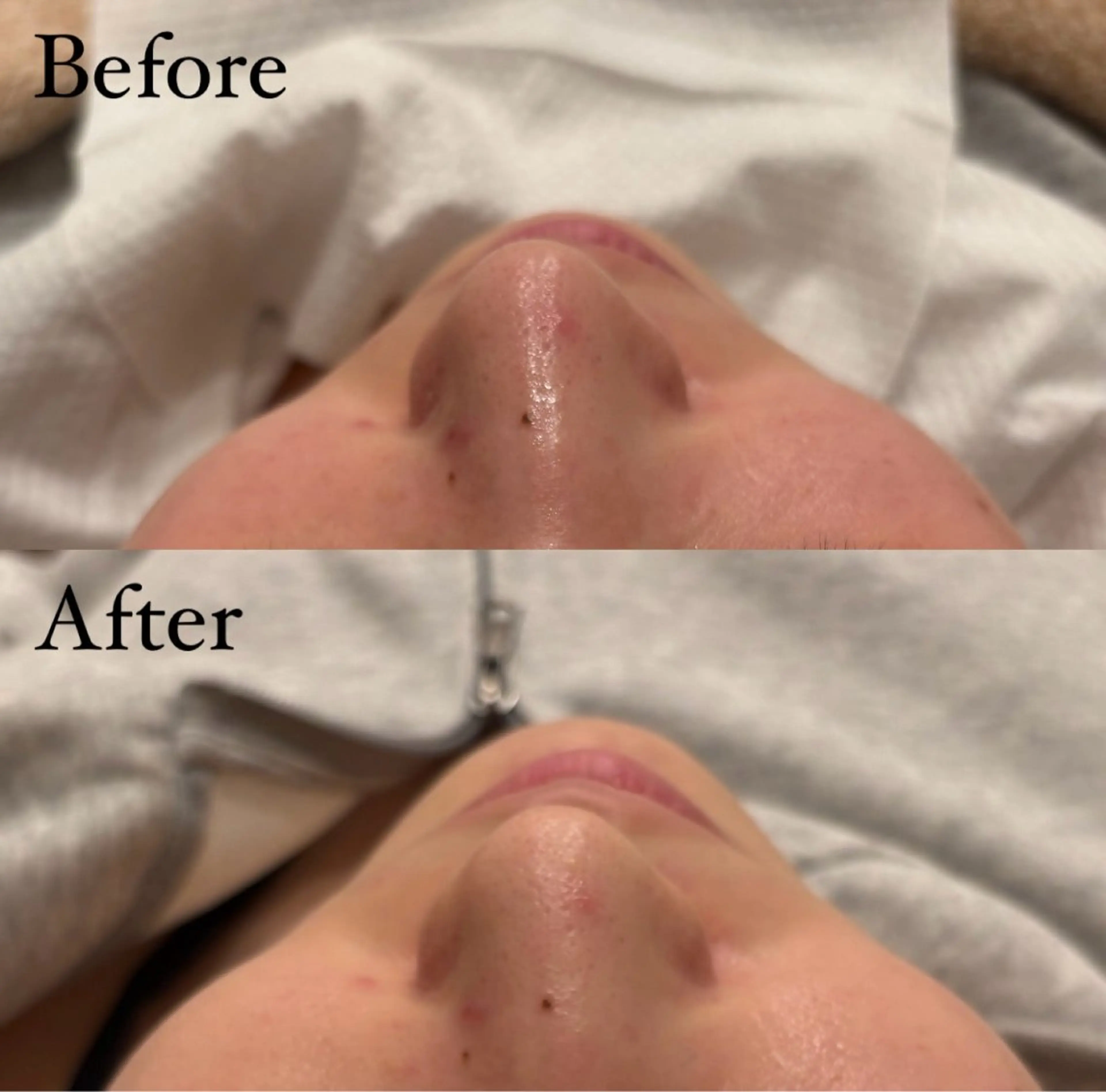 seika🍒 ハリラウンジ梅田のエステ・リラクイメージ