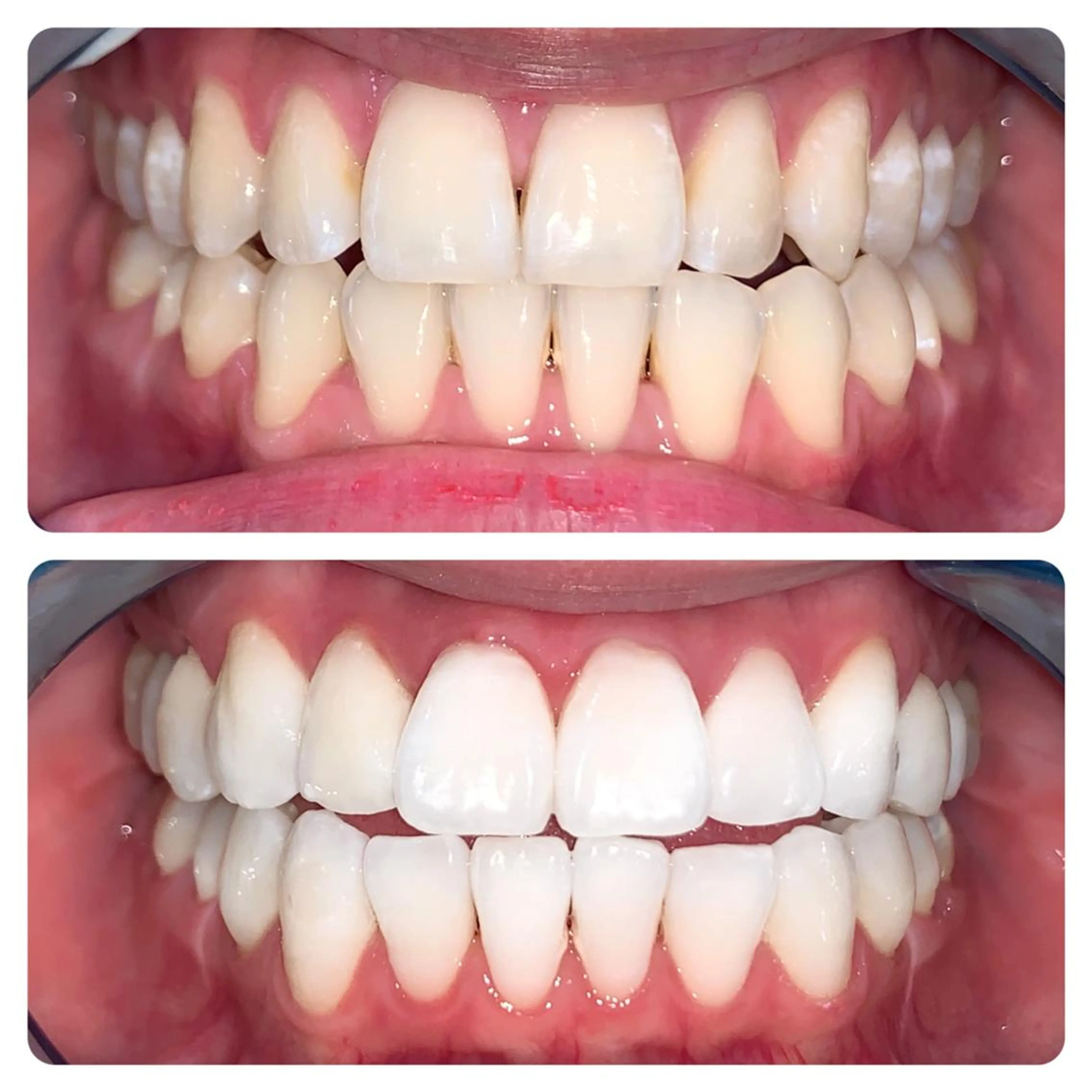 メンズ エステ リラク ライトビューティー 銀座店のエステ・リラクイメージ