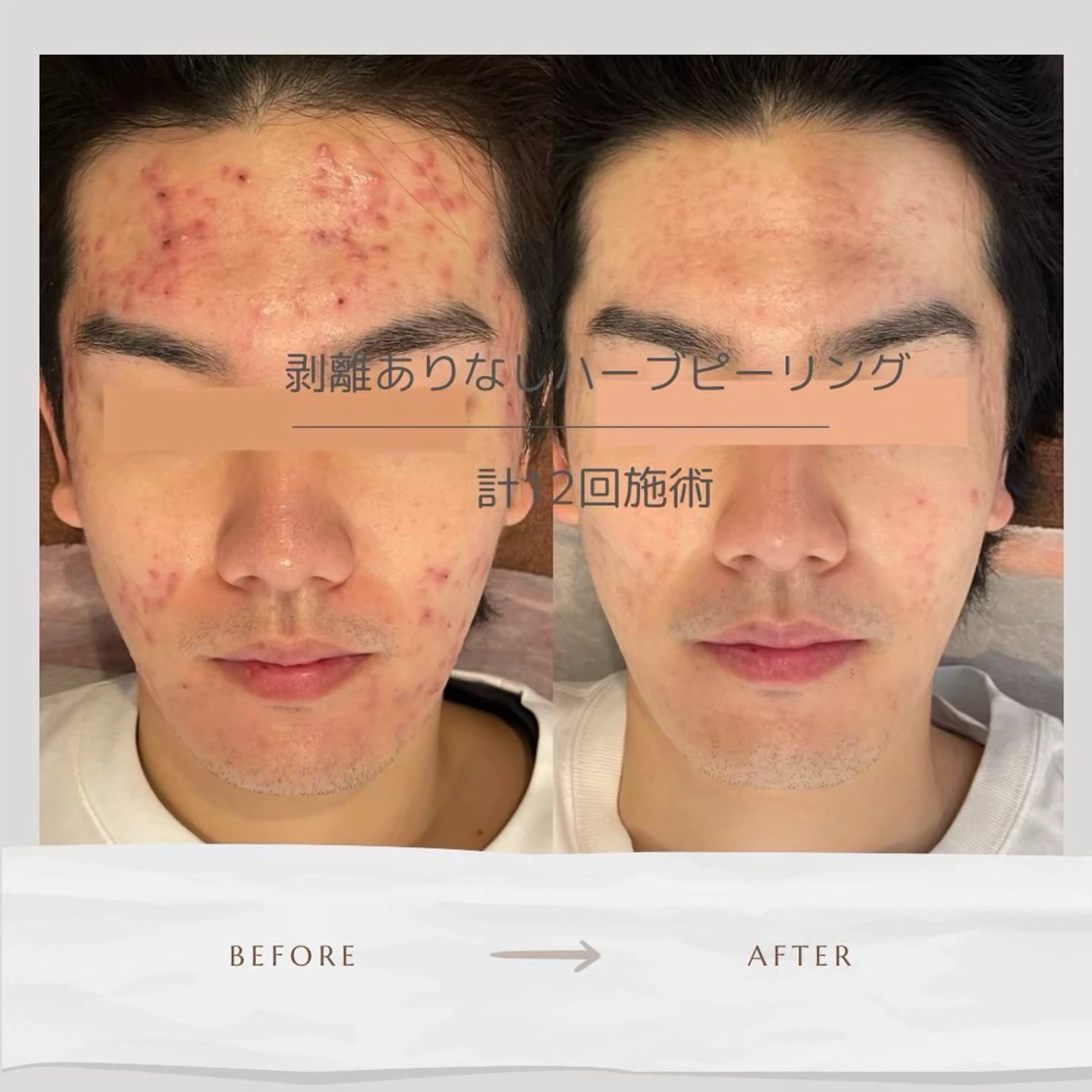 Life Salon別府店のエステ・リラクイメージ