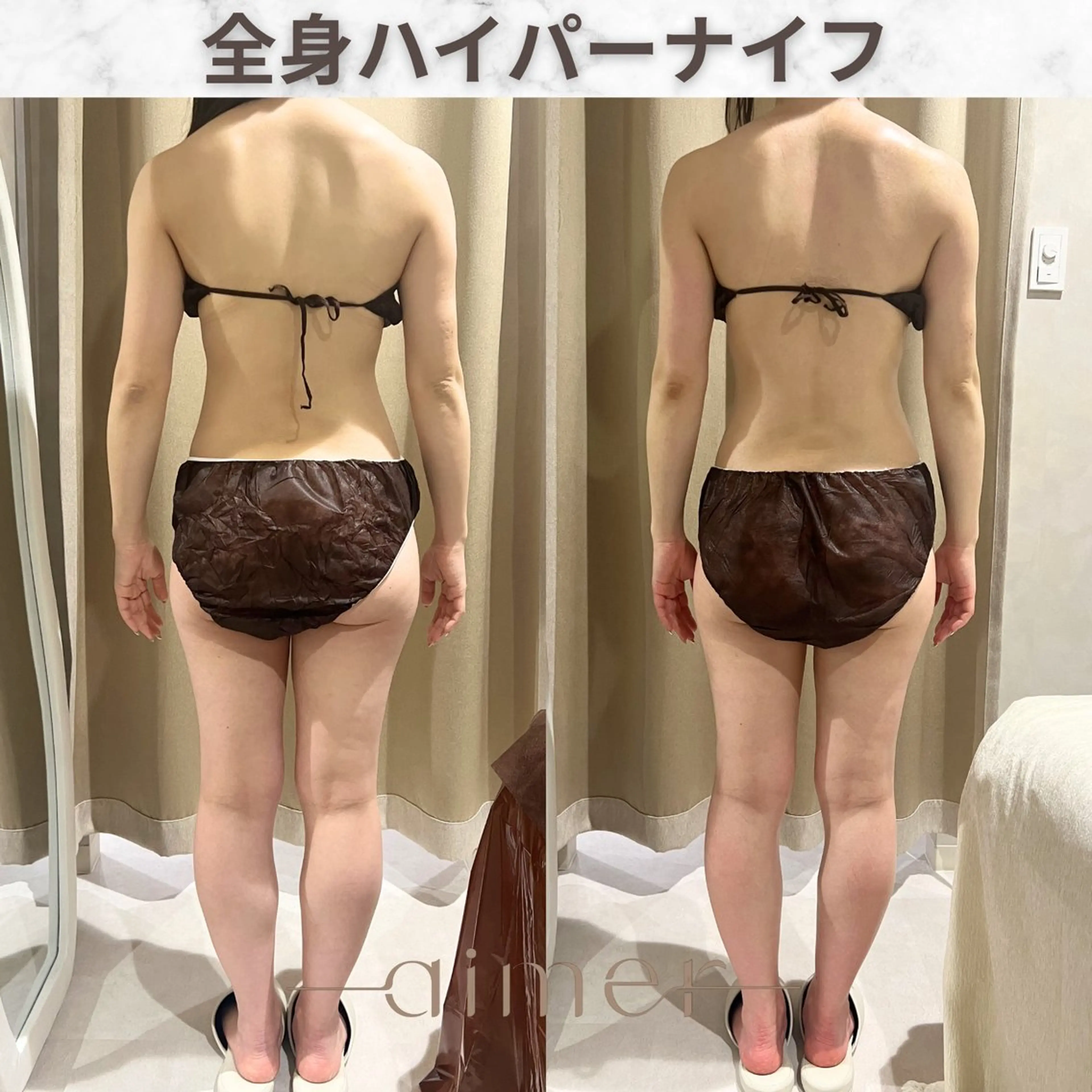 エステ aimer服部 /  小顔 ・ 痩身のその他イメージ