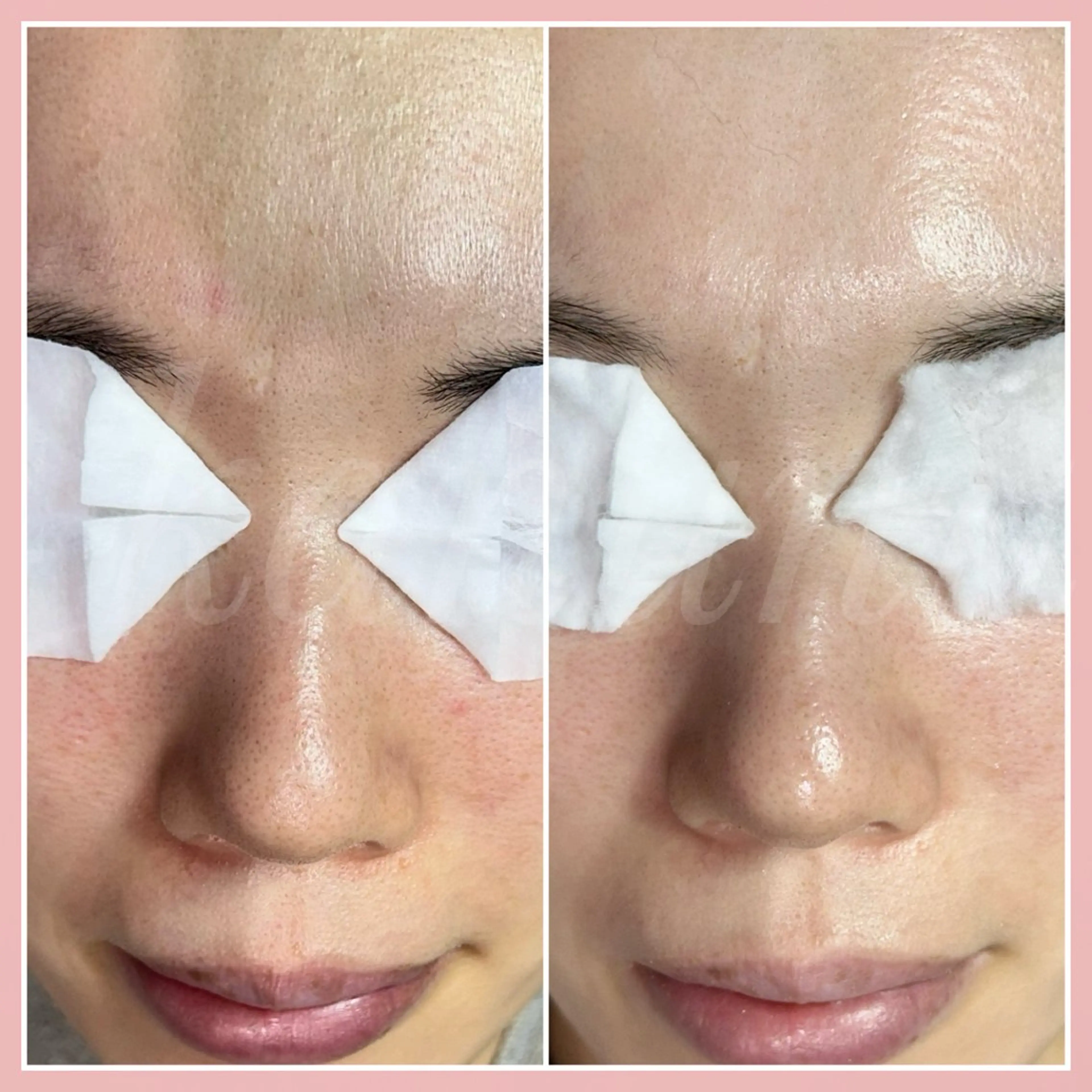 エステ kanunu♡mana所属・豊橋/毛穴特化エステ 深層デトックスリンパのエステ・リラクイメージ