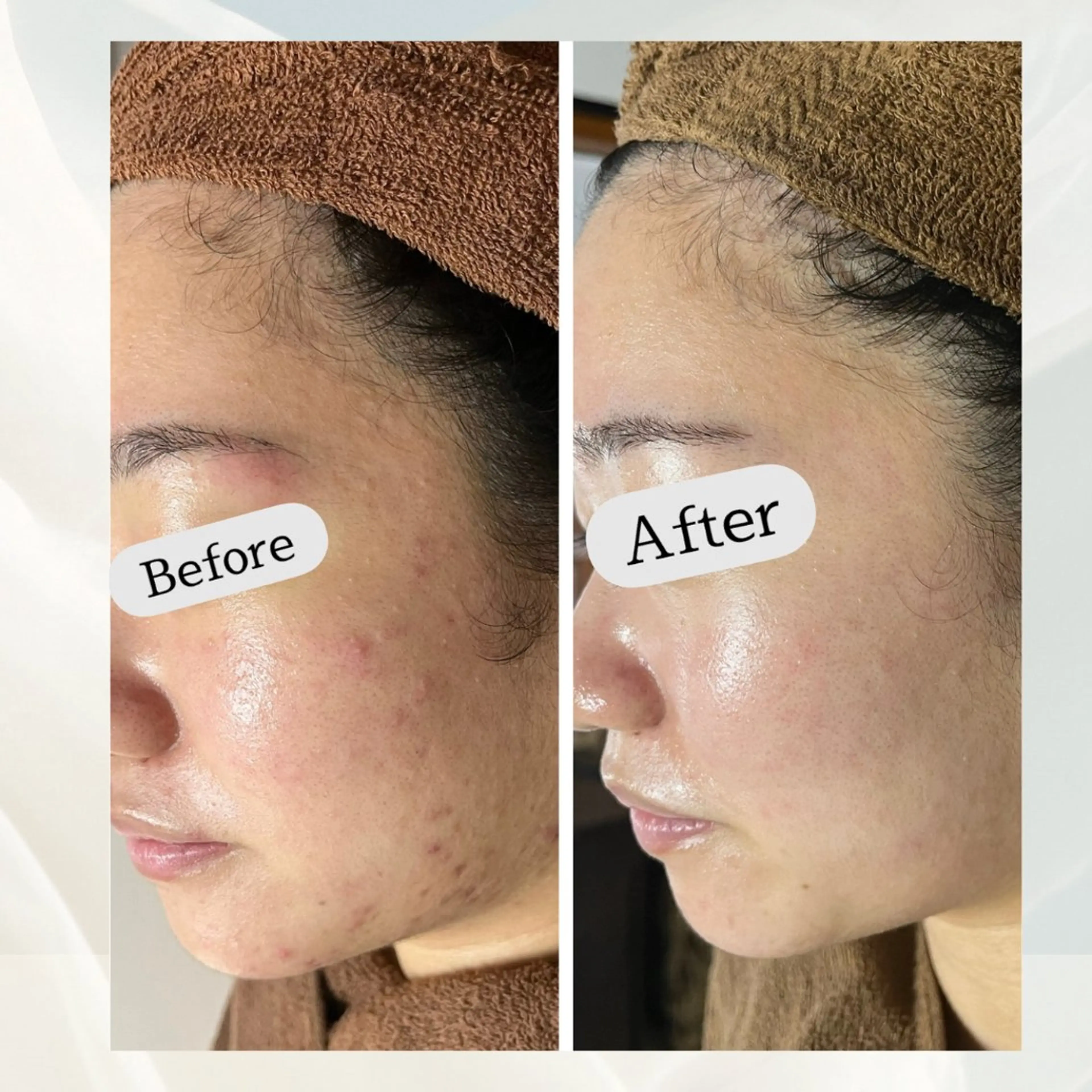 Safari Bloomのエステ・リラクイメージ