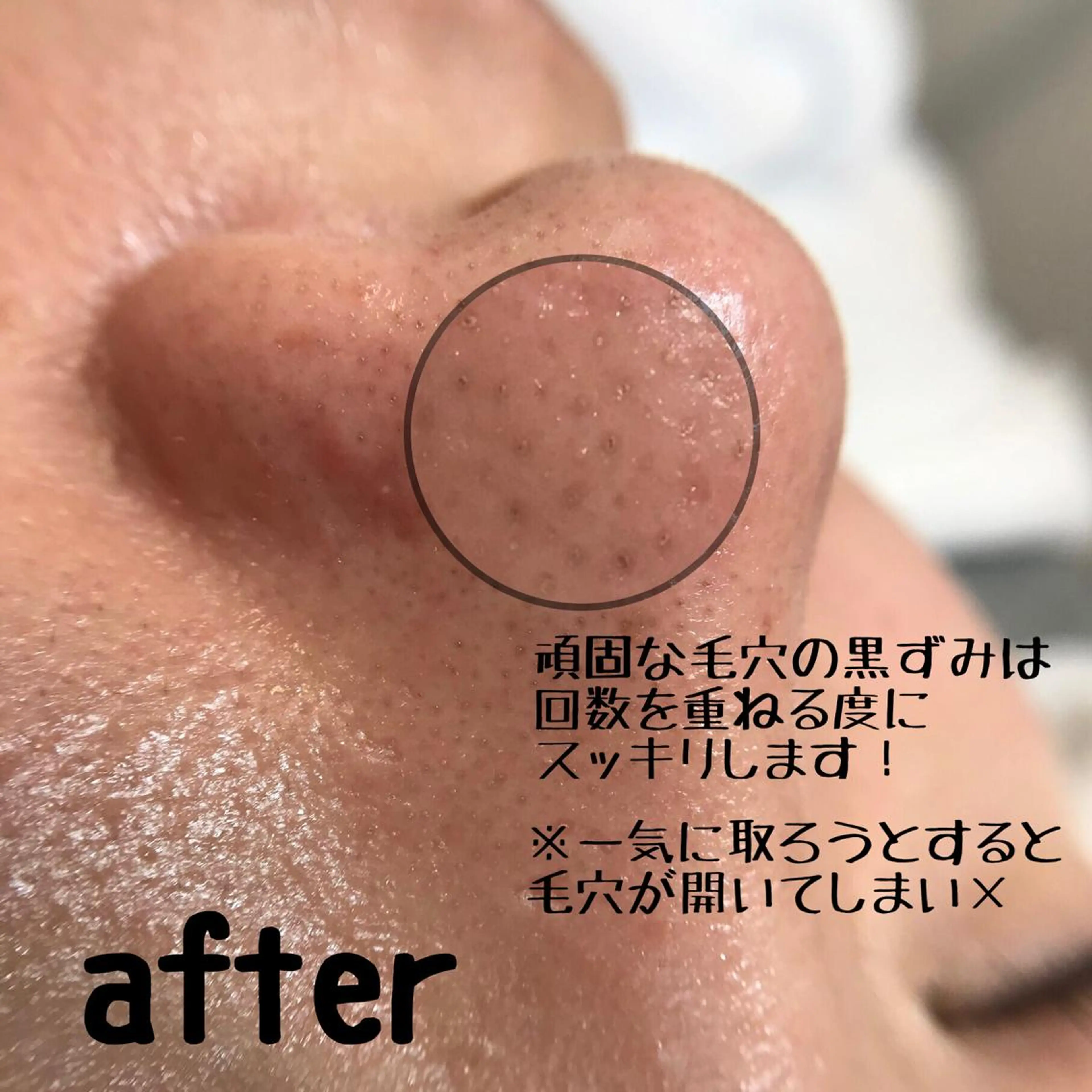 🌊🌊__ juna__のマツエク・マツパデザイン