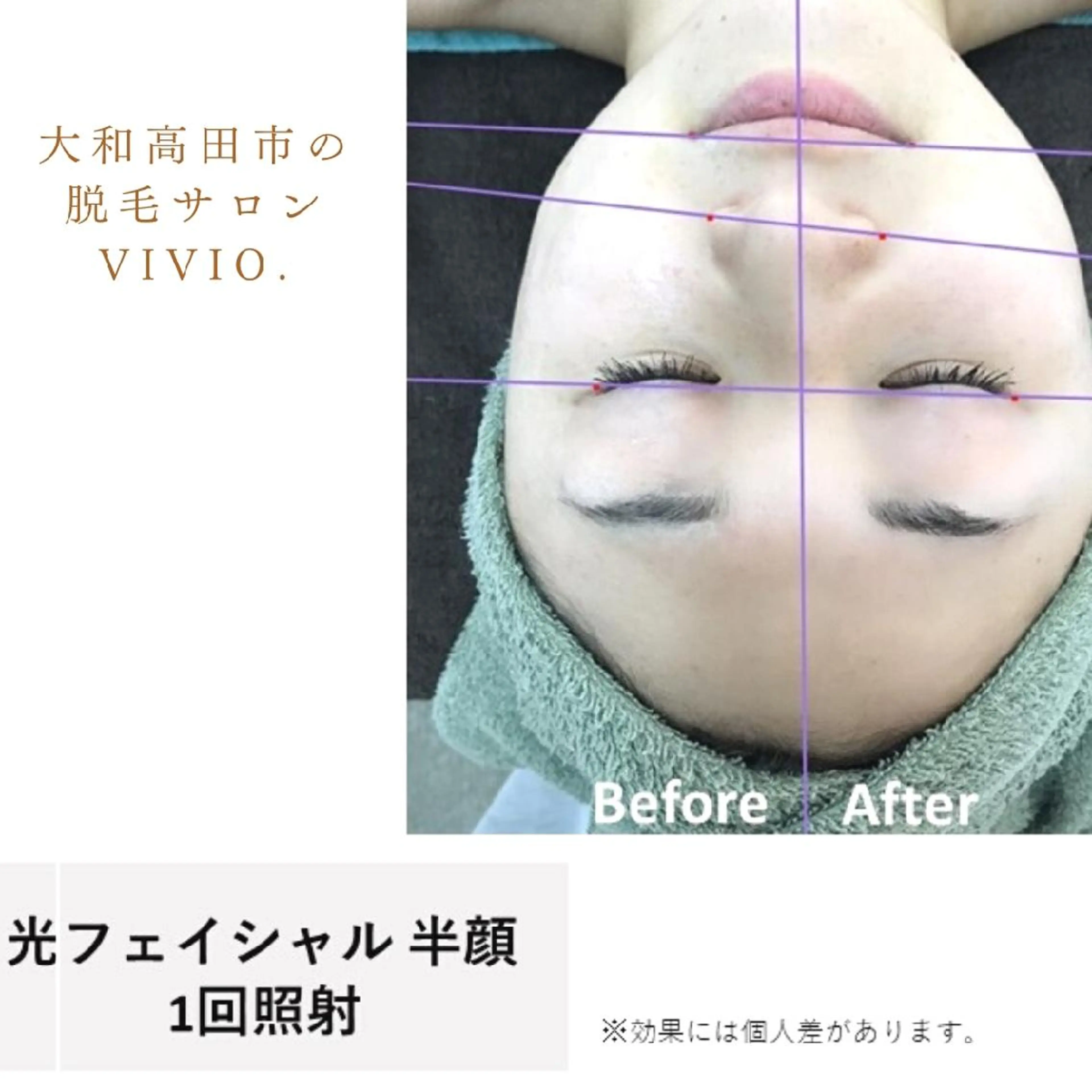 女性専用脱毛 サロンvivio.のエステ・リラクイメージ