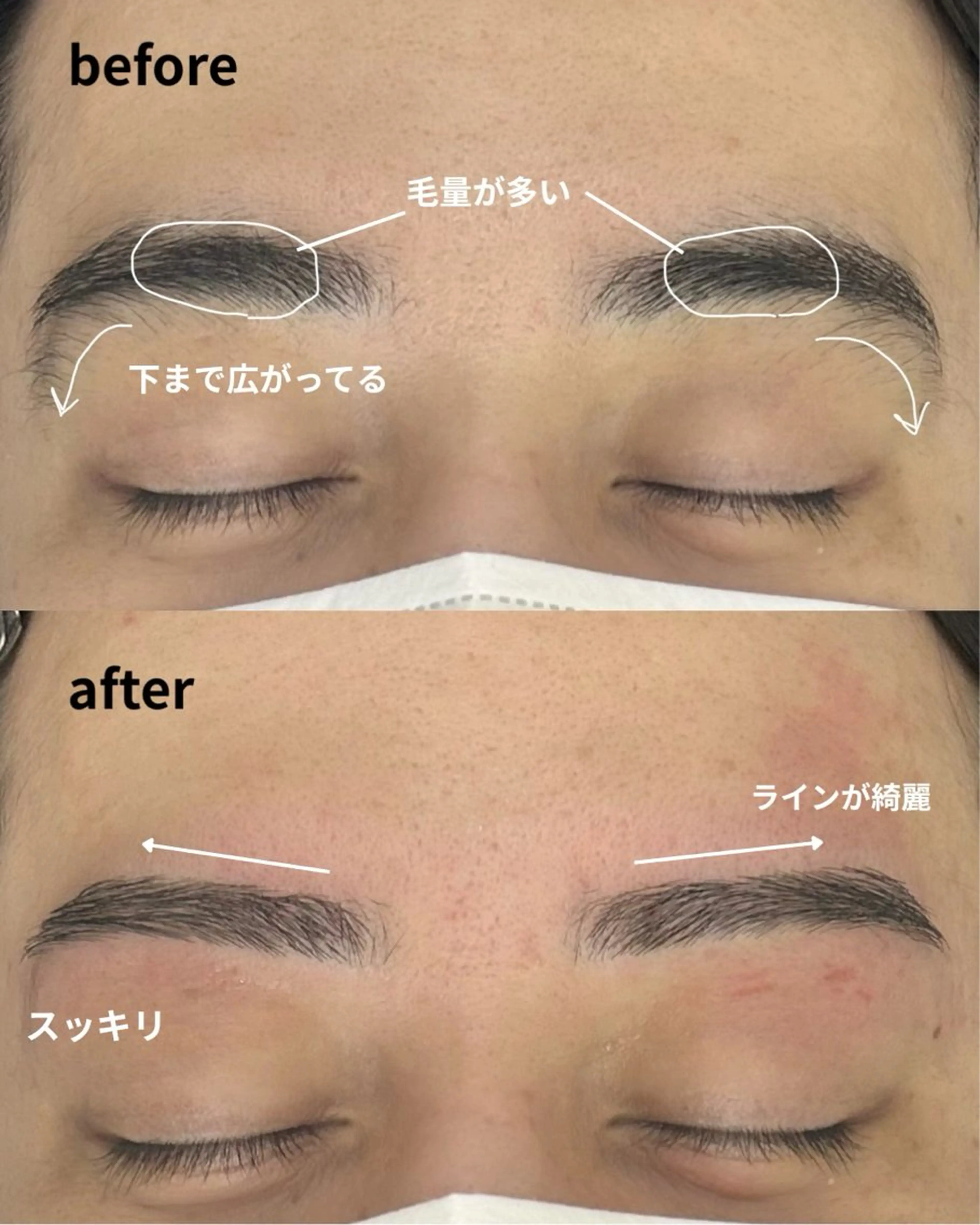 メンズ アイブロウ ワックス脱毛 眉カット SENSE 【メンズ専門眉毛】の眉毛・アイブロウイメージ