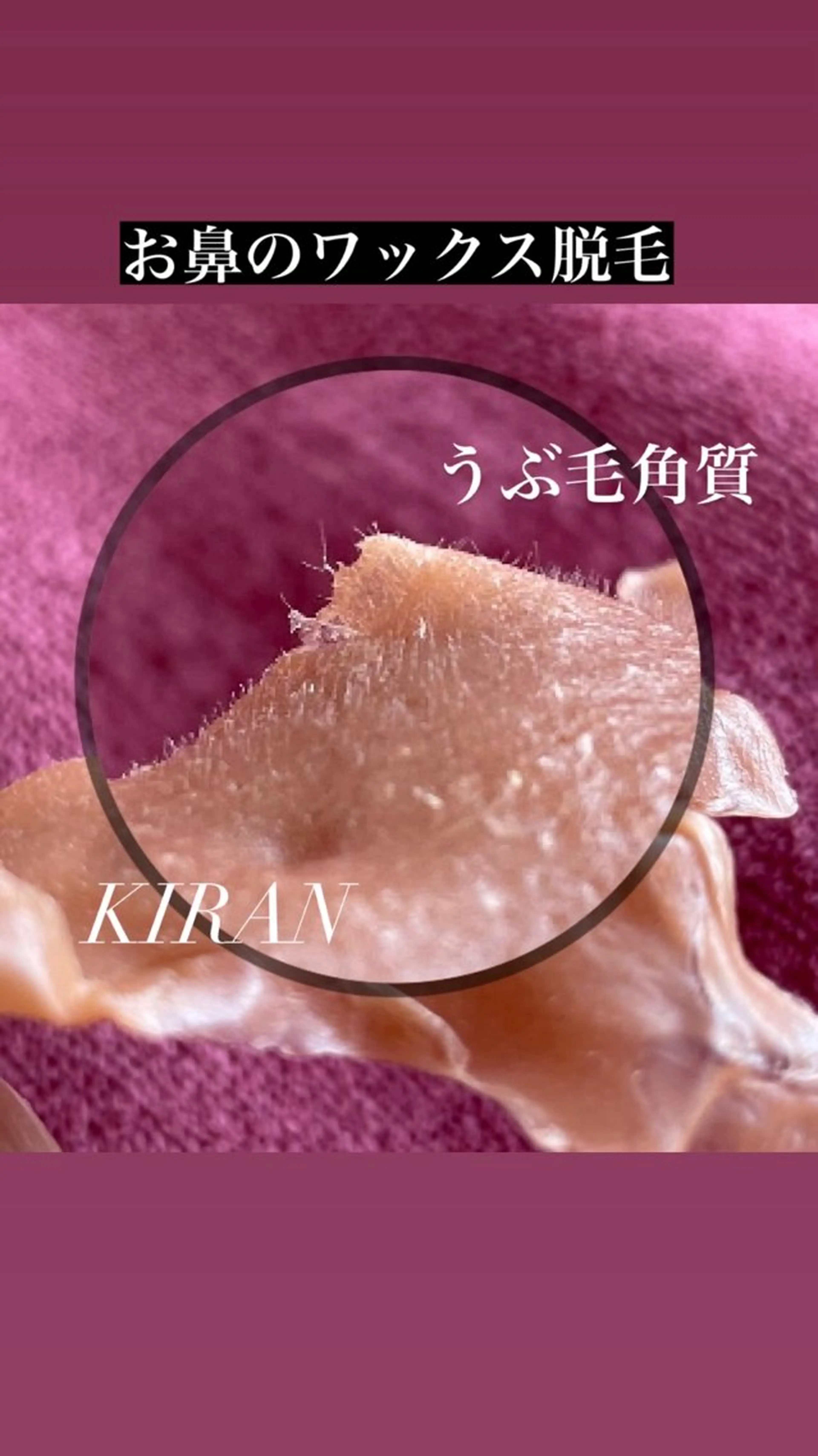 顔ワックス脱毛+パックの写真