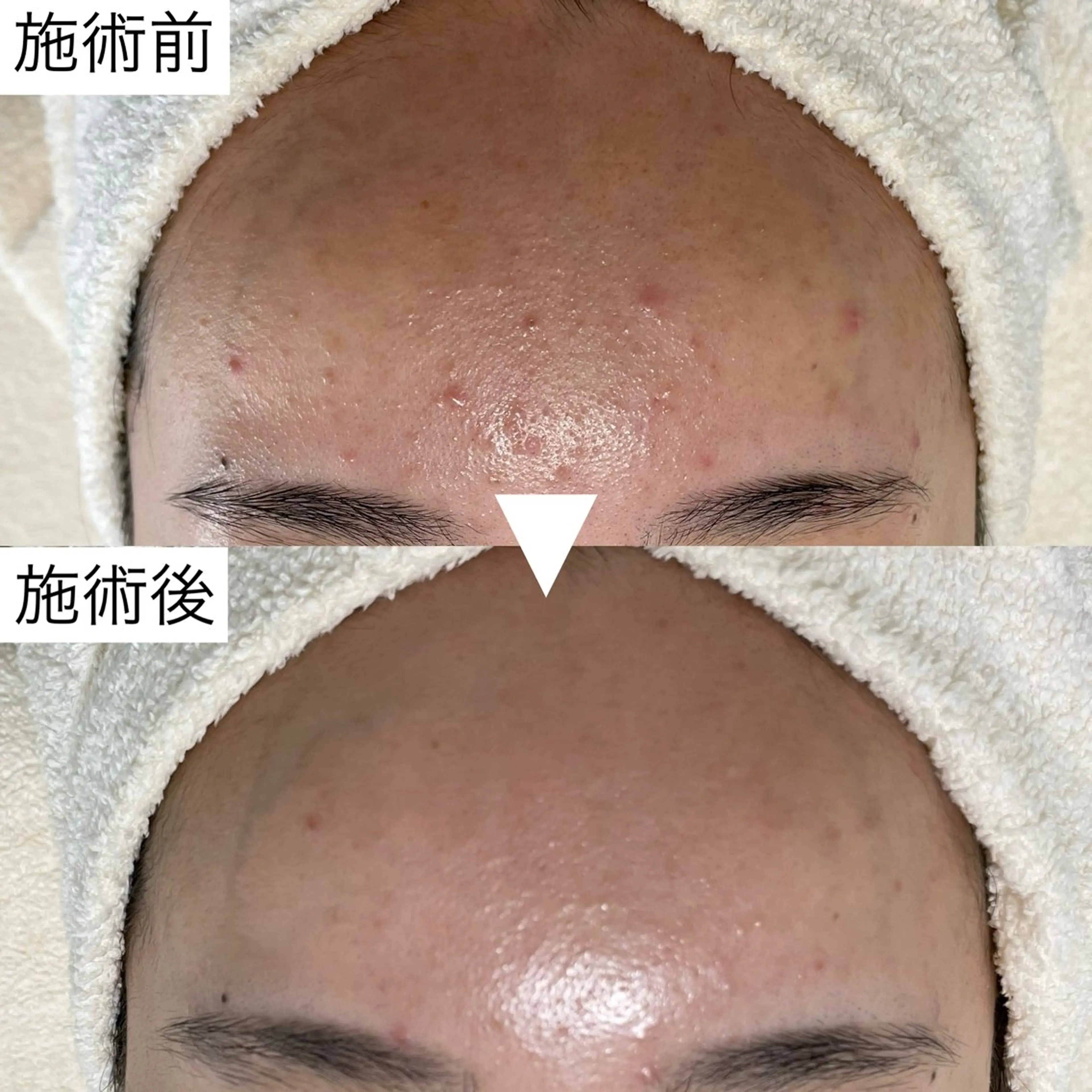 シェノン所属・ニキビ・毛穴・ フェイシャル専門店のエステ・リラクイメージ