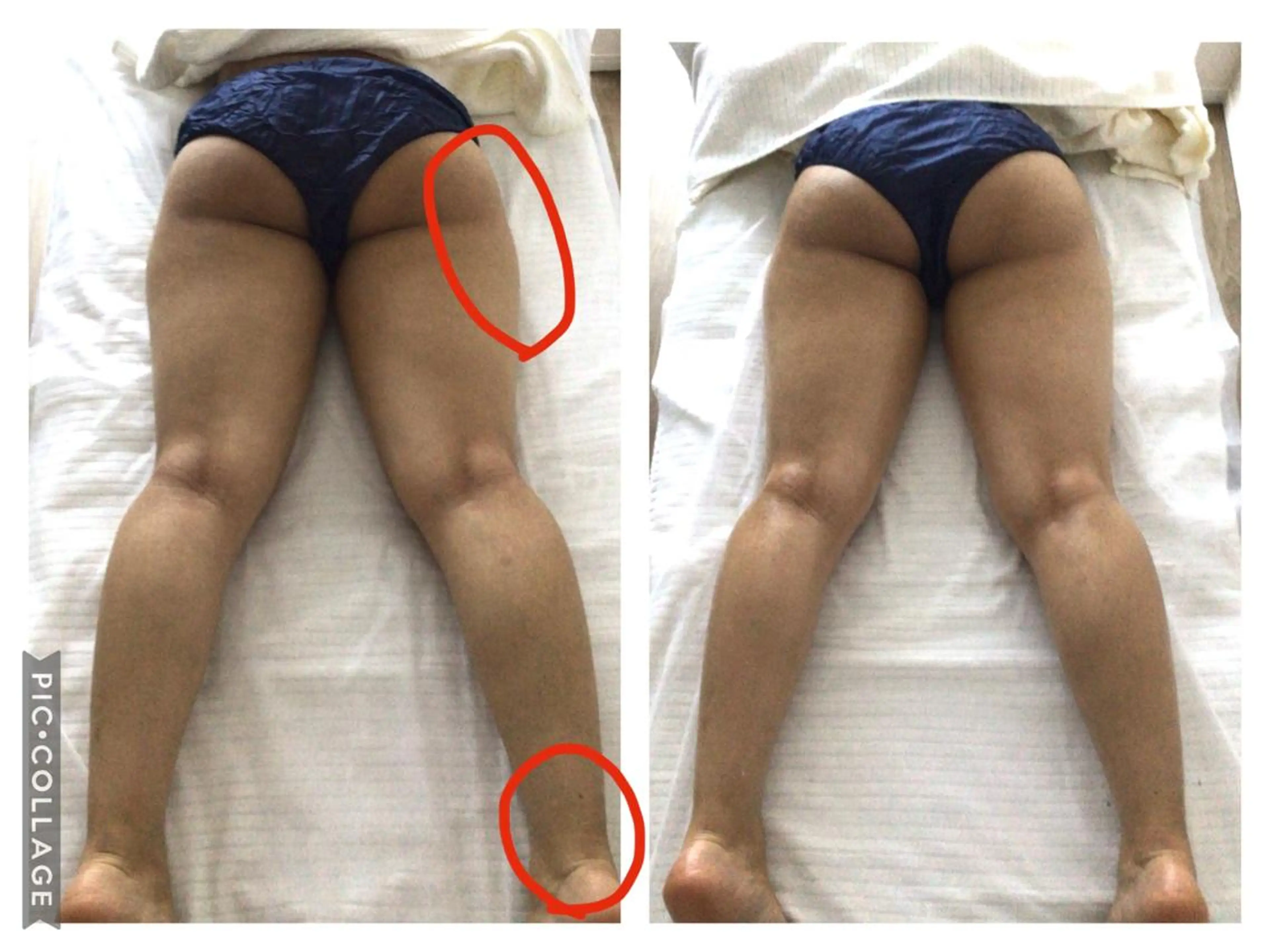 子宮矯正/腸揉み/ シュガーリング脱毛のエステ・リラクイメージ