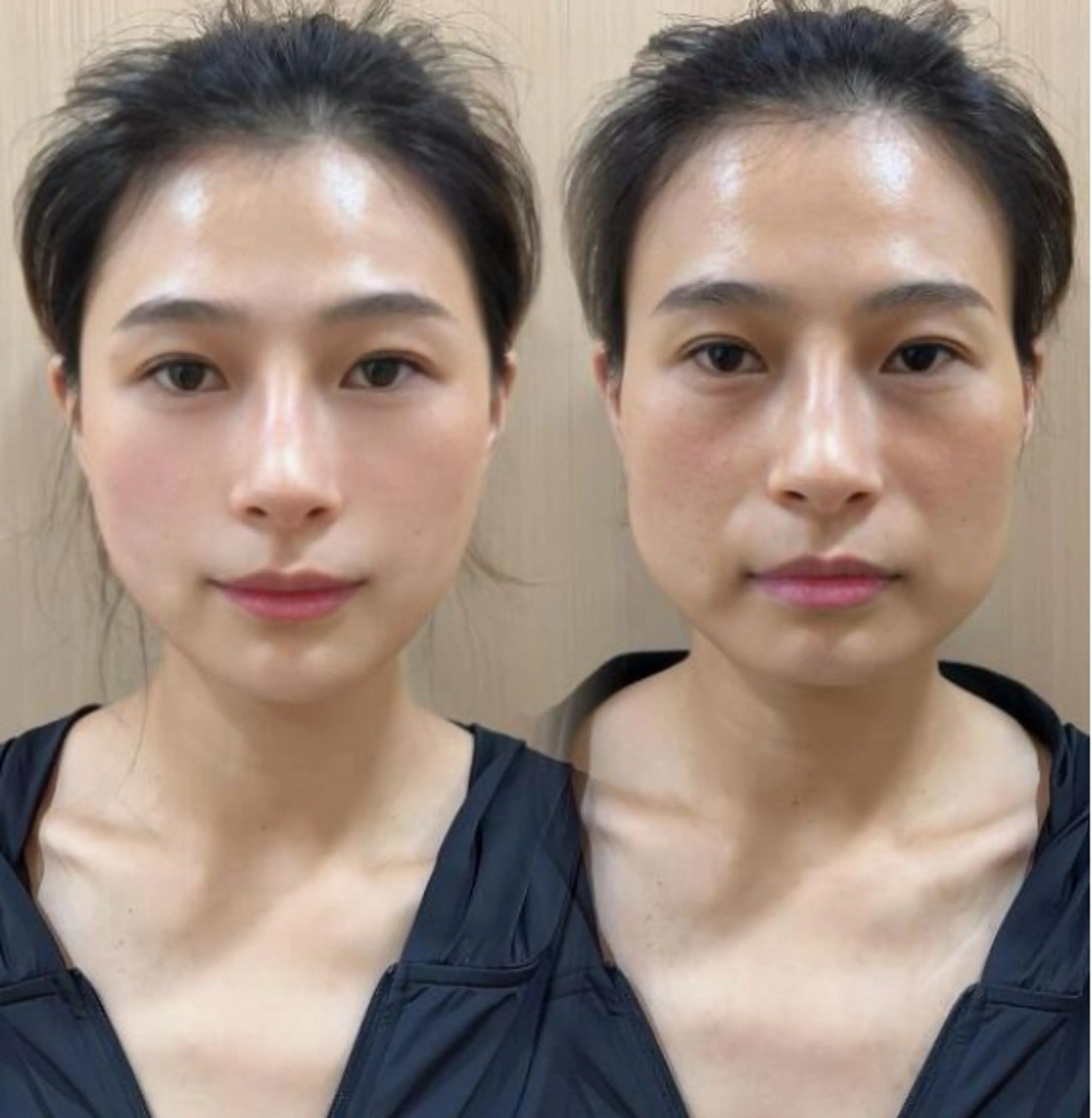 ネイル エステ aliaハーブ水光店 エステティシャン募集のエステ・リラクイメージ