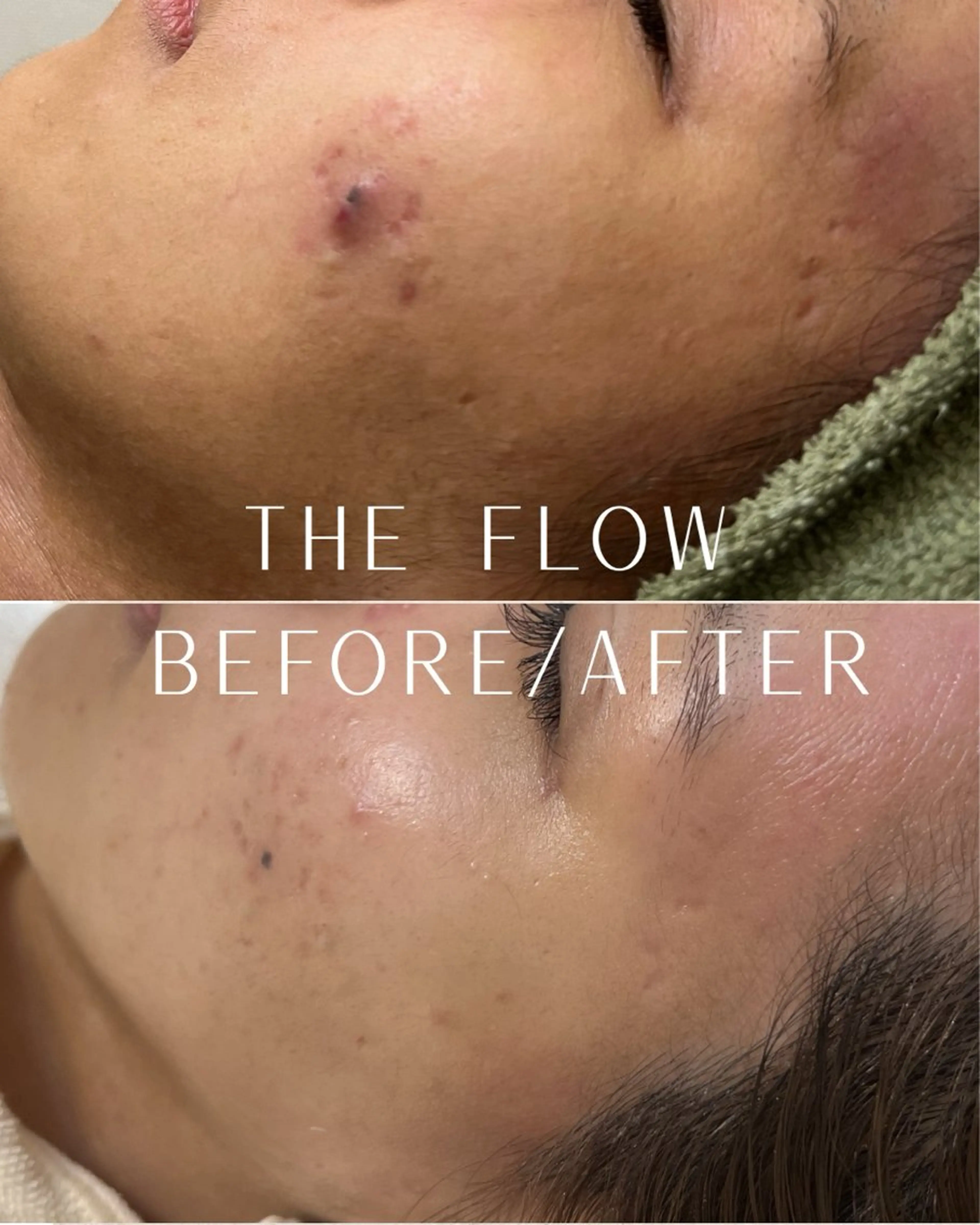 エステ 稲垣 優のエステ・リラクイメージ