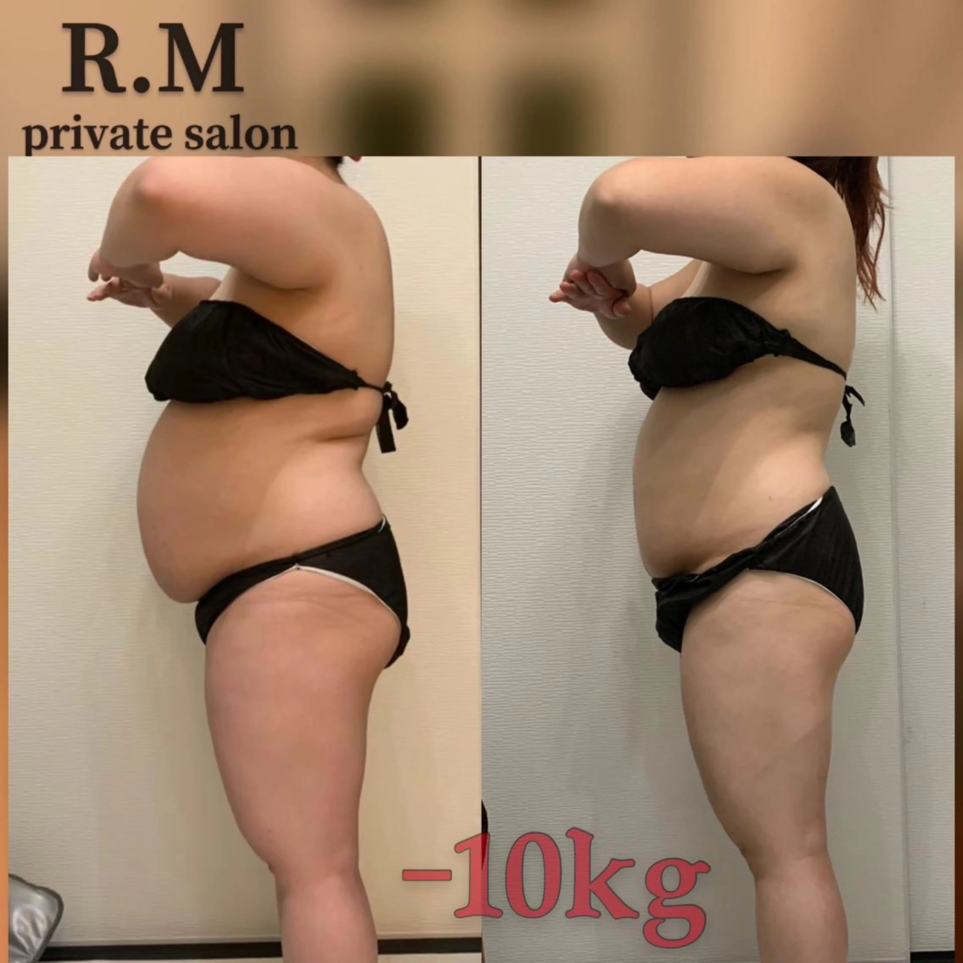 【女性様専用】90分！キャビテーションとバキュームで全身セルライトケア❣️の写真