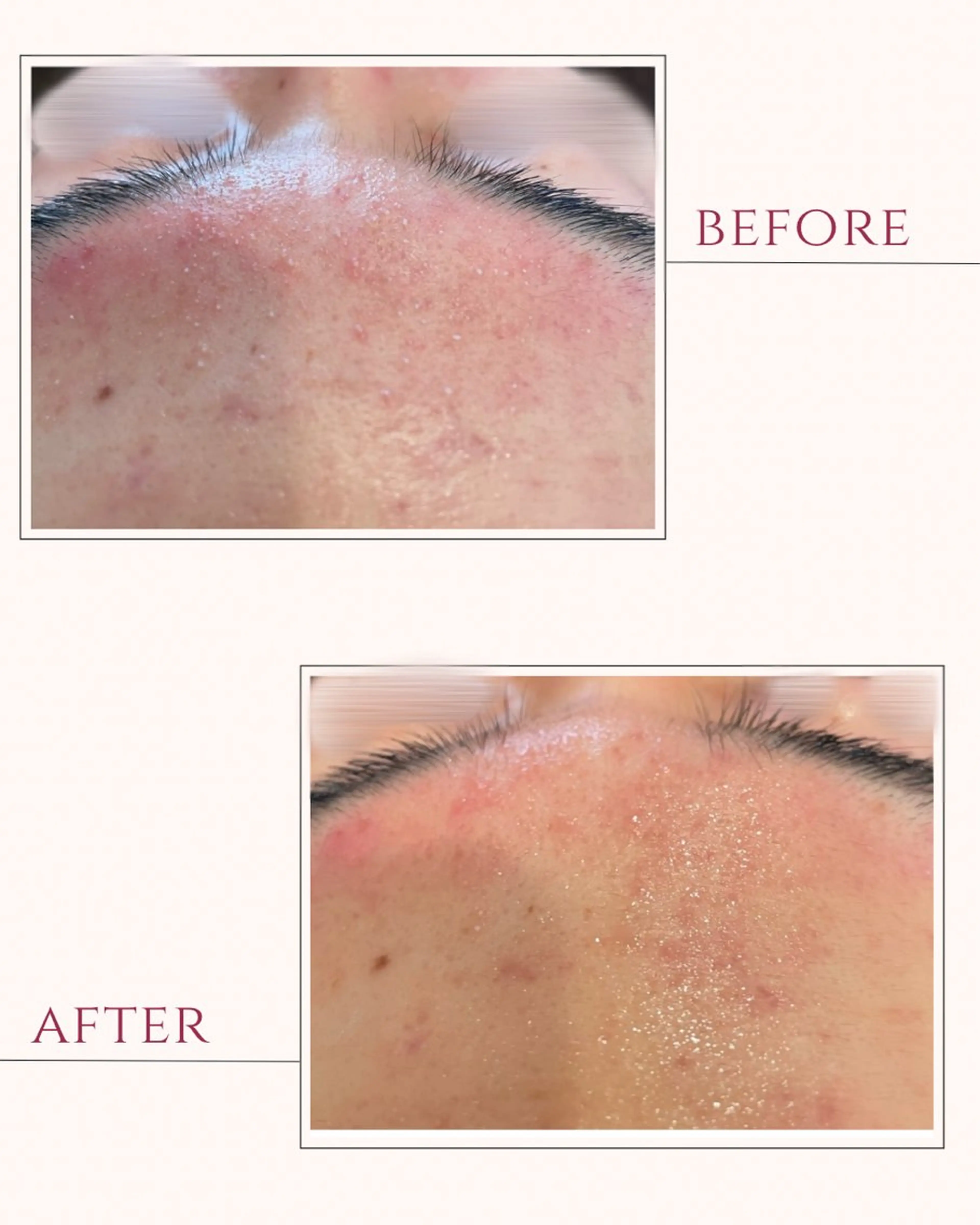 エステ 倉敷/玉島/20代 からの大人毛穴洗浄のエステ・リラクイメージ