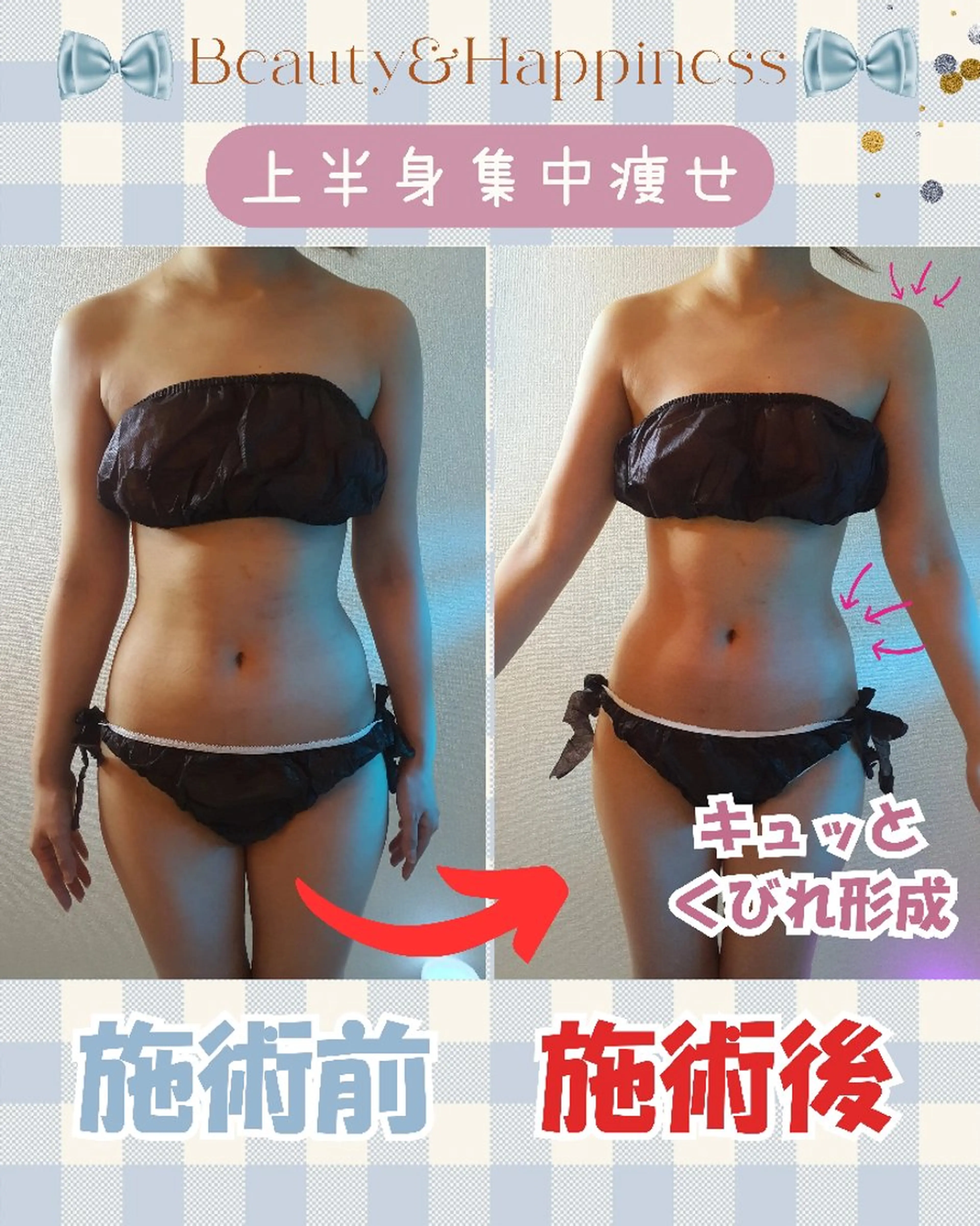 痩身ハーブピーリング 筋膜リリース☆B&Hのエステ・リラクイメージ