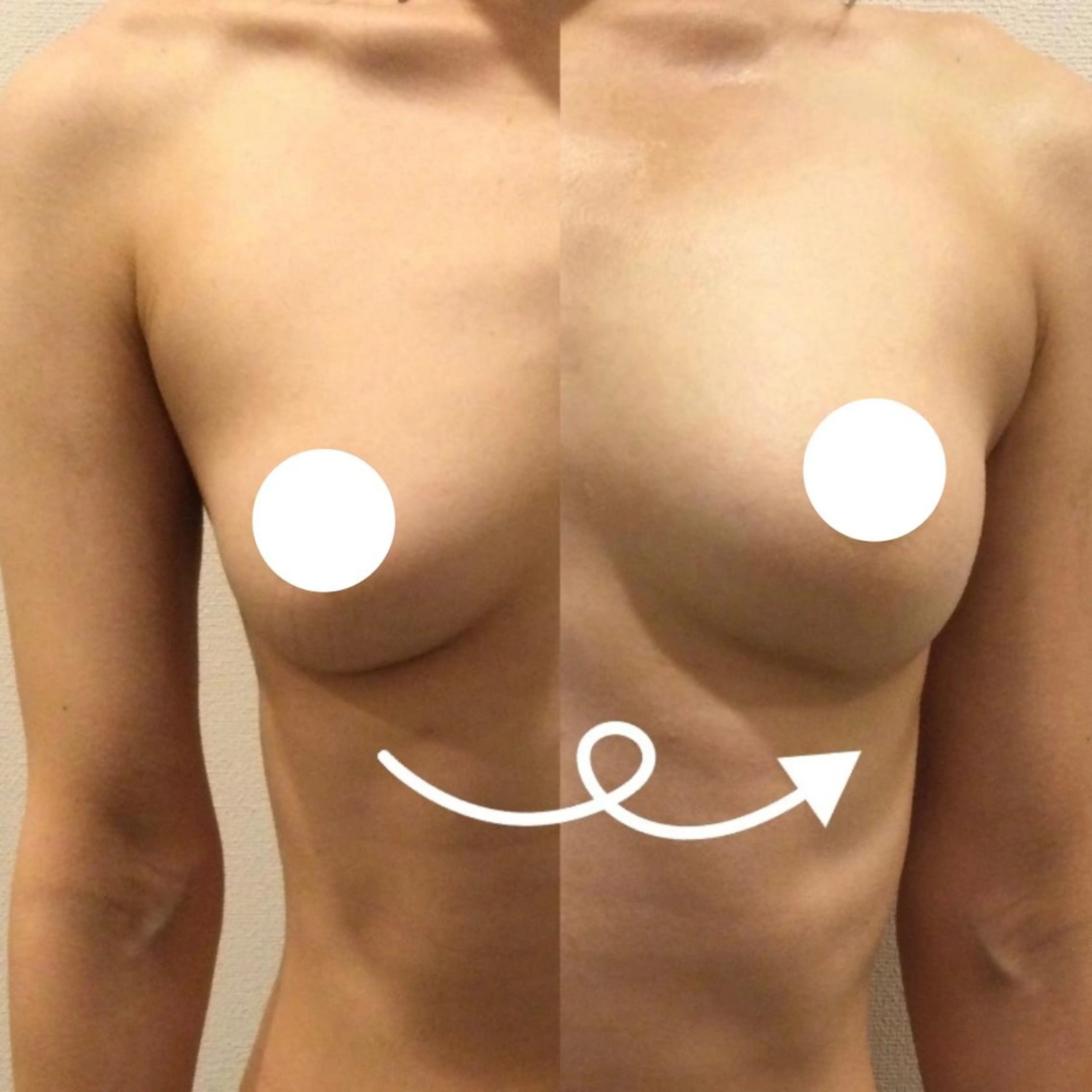 エステ バスト・脱毛・痩身 上島のエステ・リラクイメージ