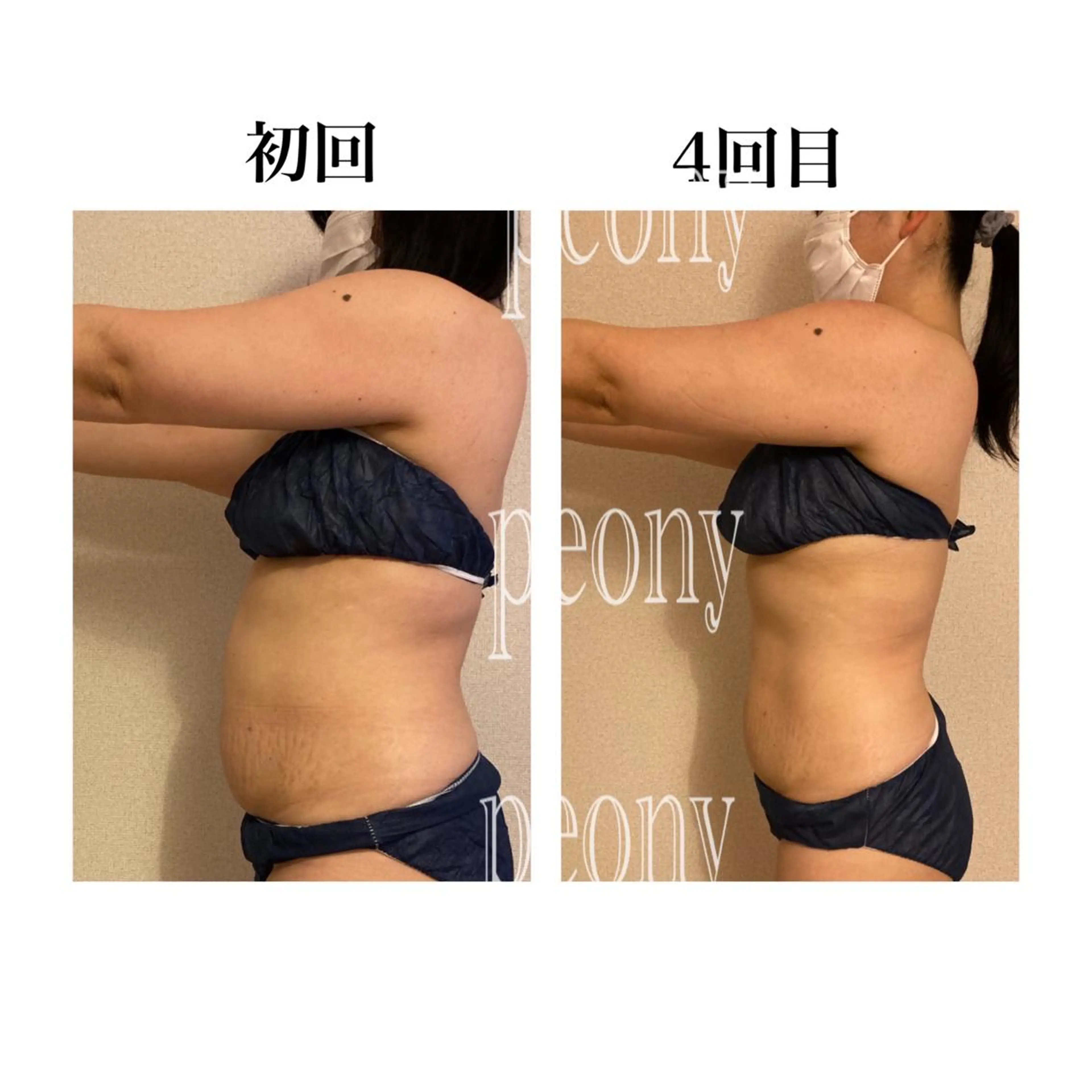 デトックス美容専門サロンpeony所属・デトックス美容専門 サロンpeonyのエステ・リラクイメージ