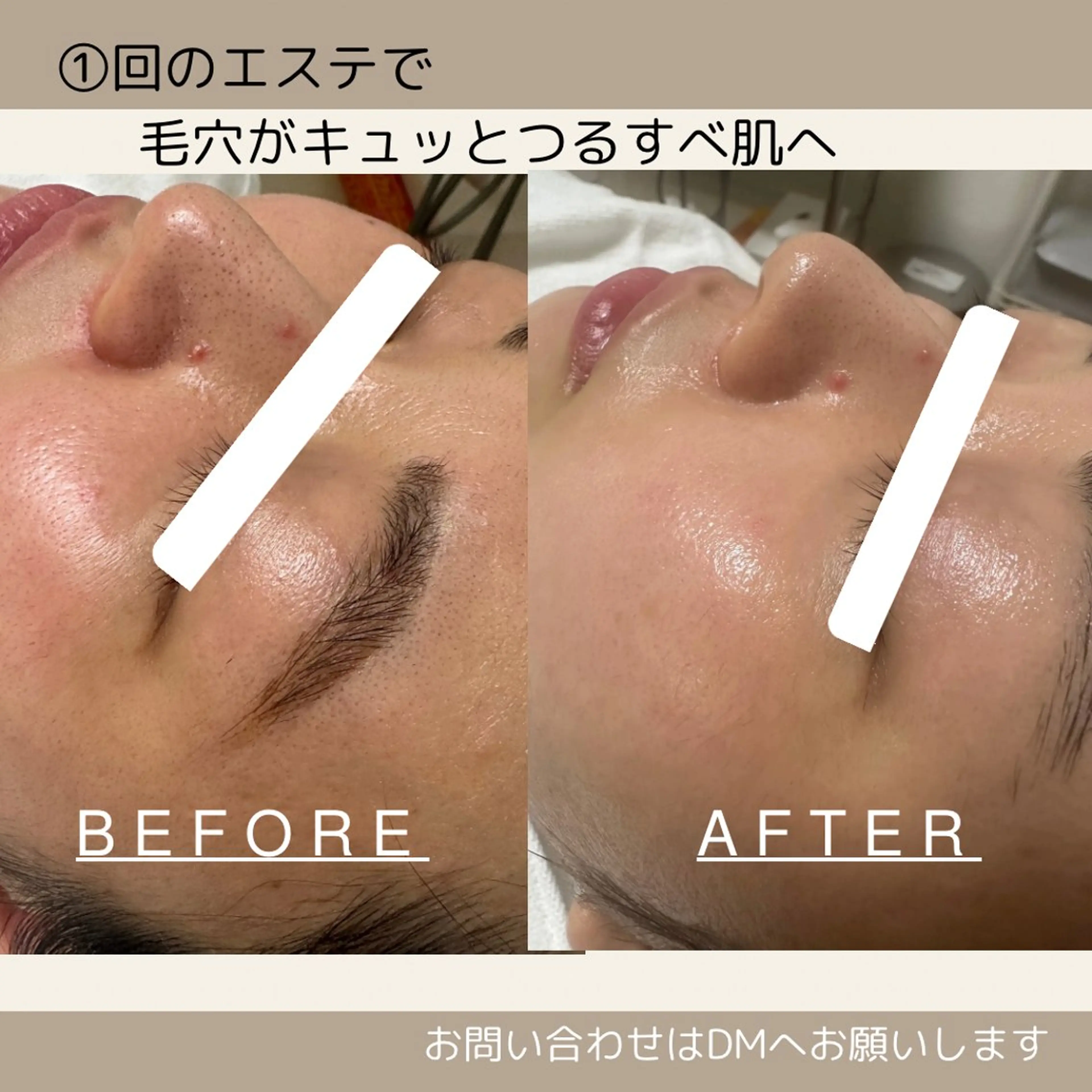 エステ DeI'm  ふなば さとみのネイルデザイン