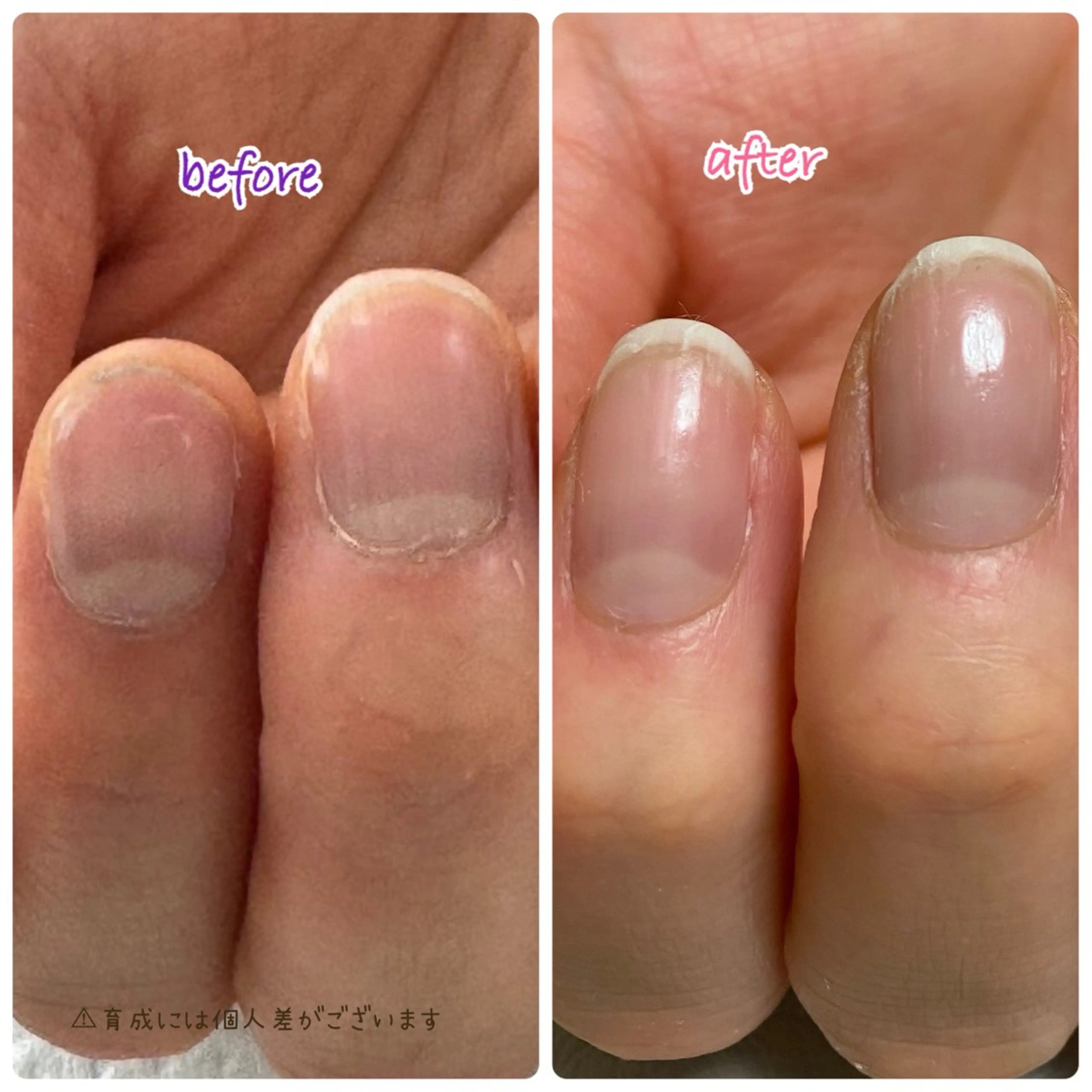ネイル その他(ネイル) Ella nail ちゆうのネイルデザイン