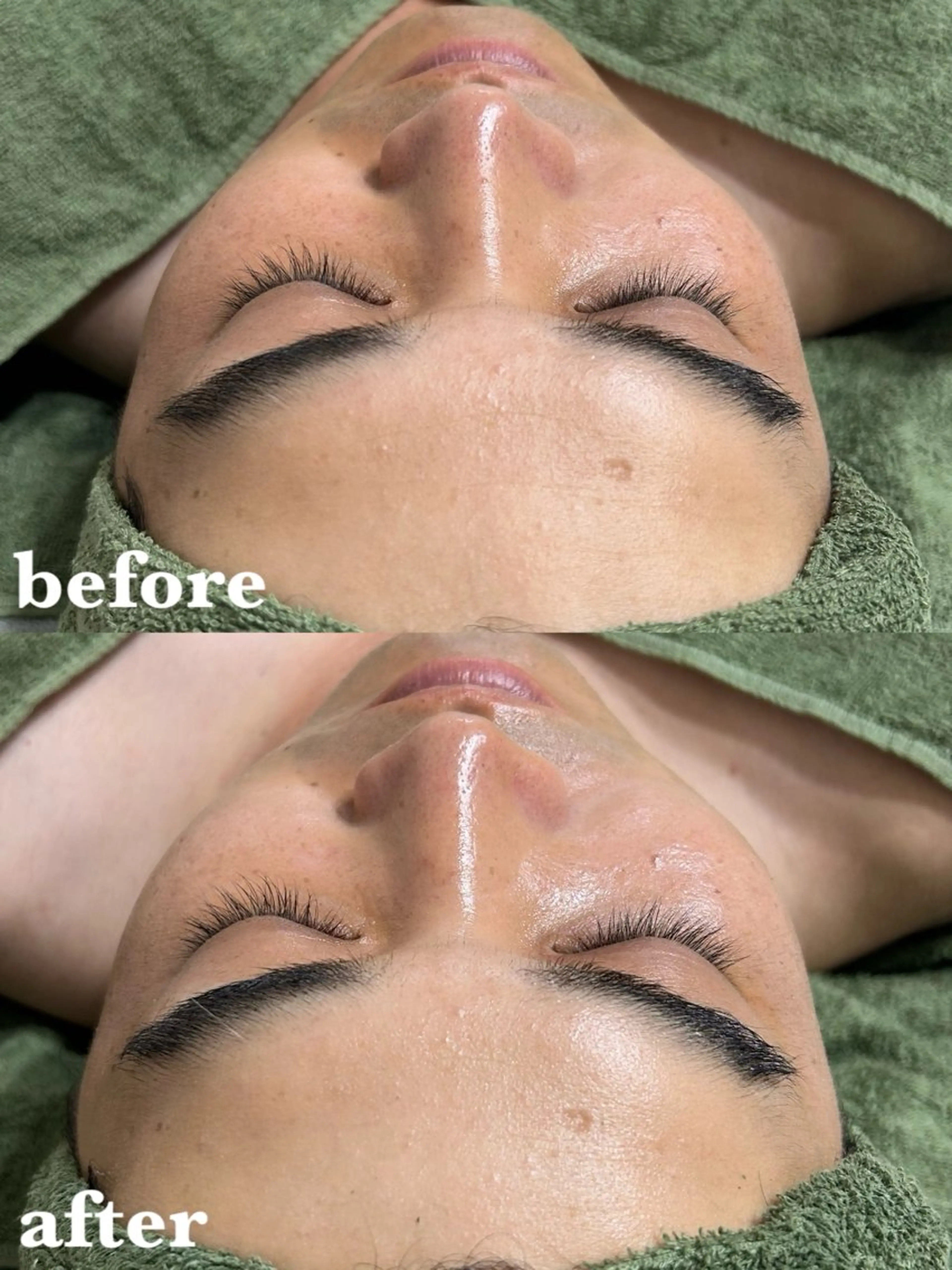 メンズ 肌質改善＆脱毛 【M Mondo】のエステ・リラクイメージ