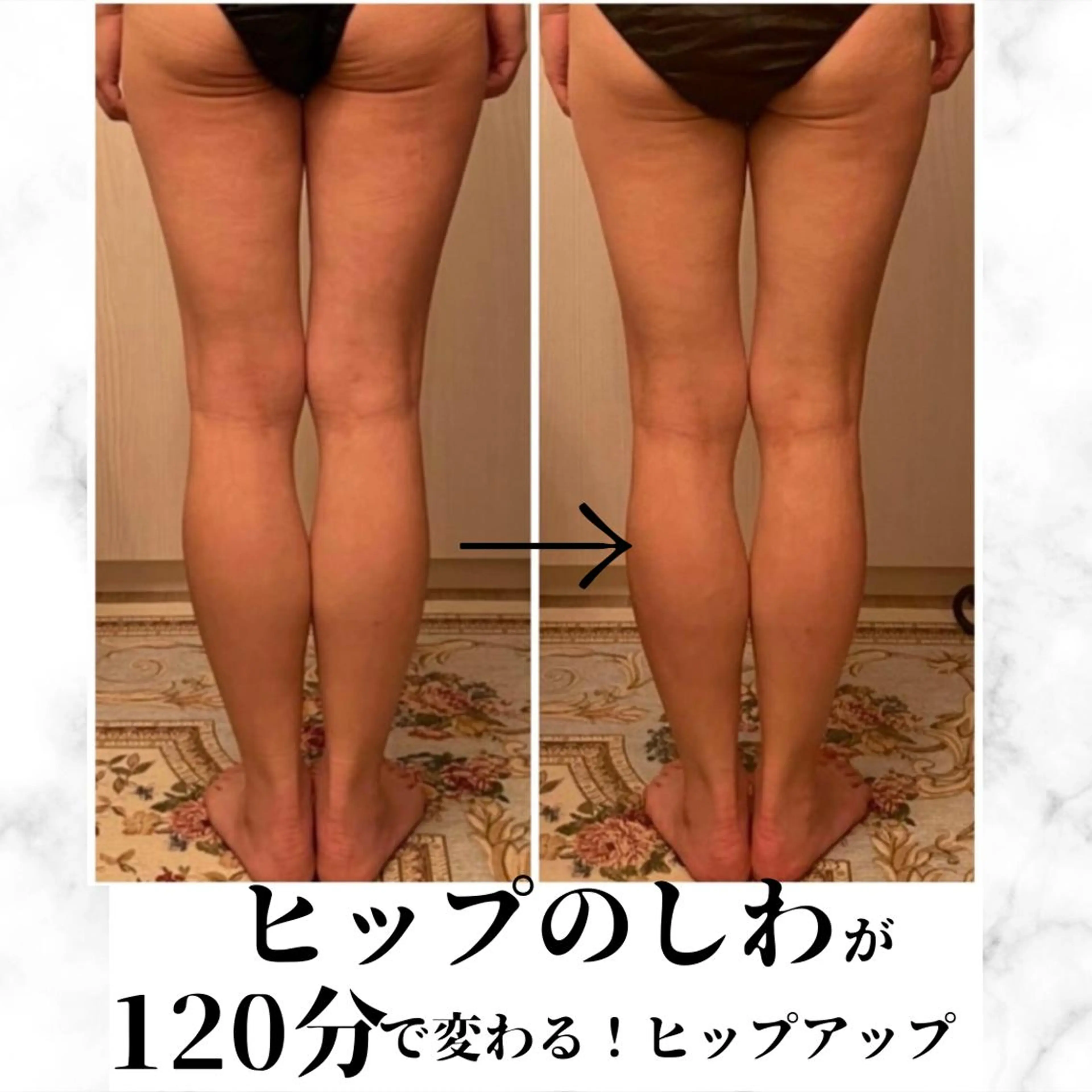 食べながら魅せボディ éclatJua川越のエステ・リラクイメージ